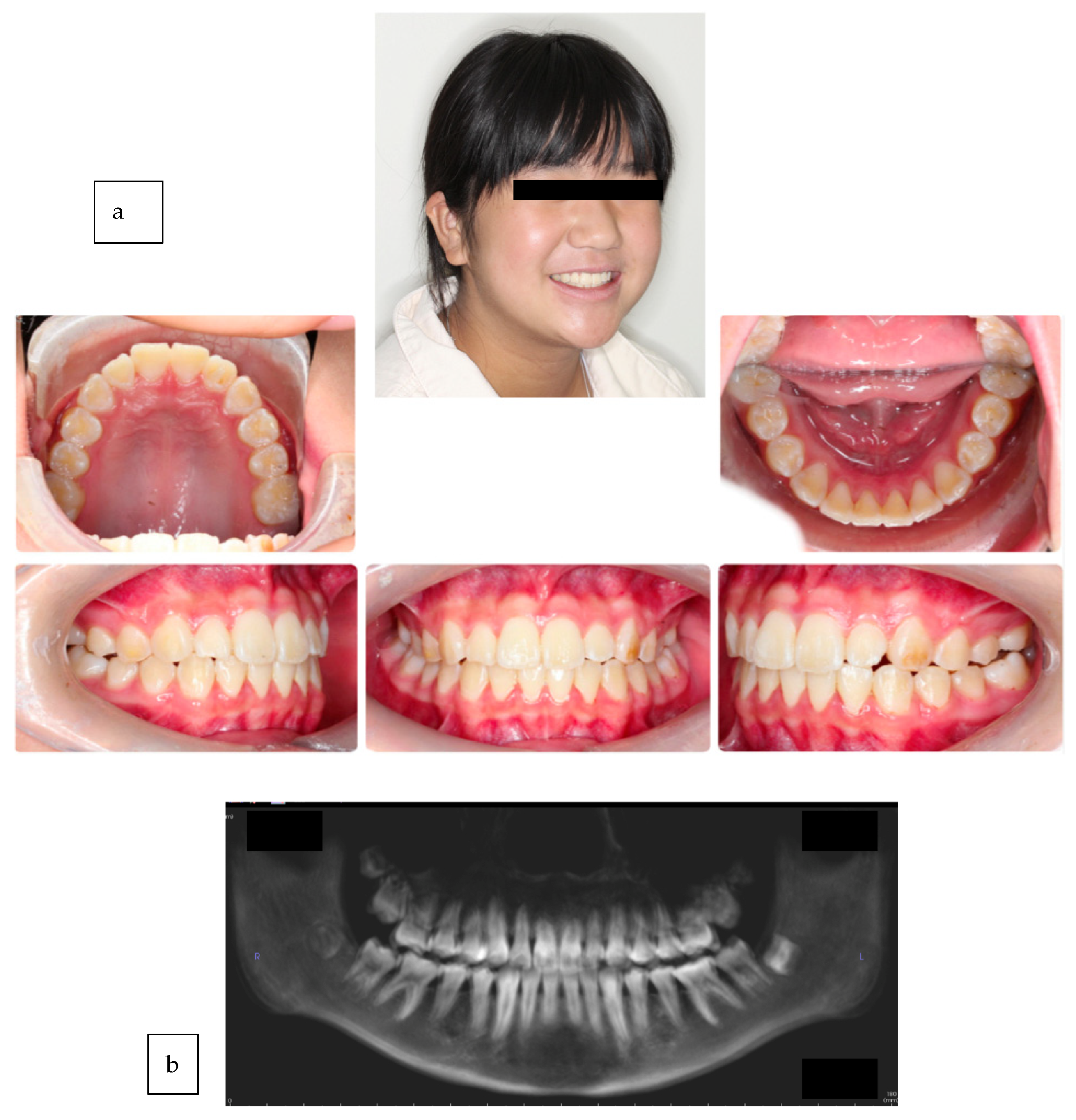 Medicina 59 01773 g003 Medicina 59 01773 g003