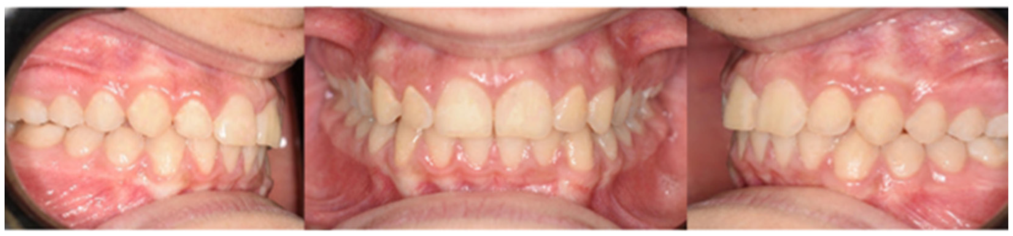 Medicina 59 01774 g006b