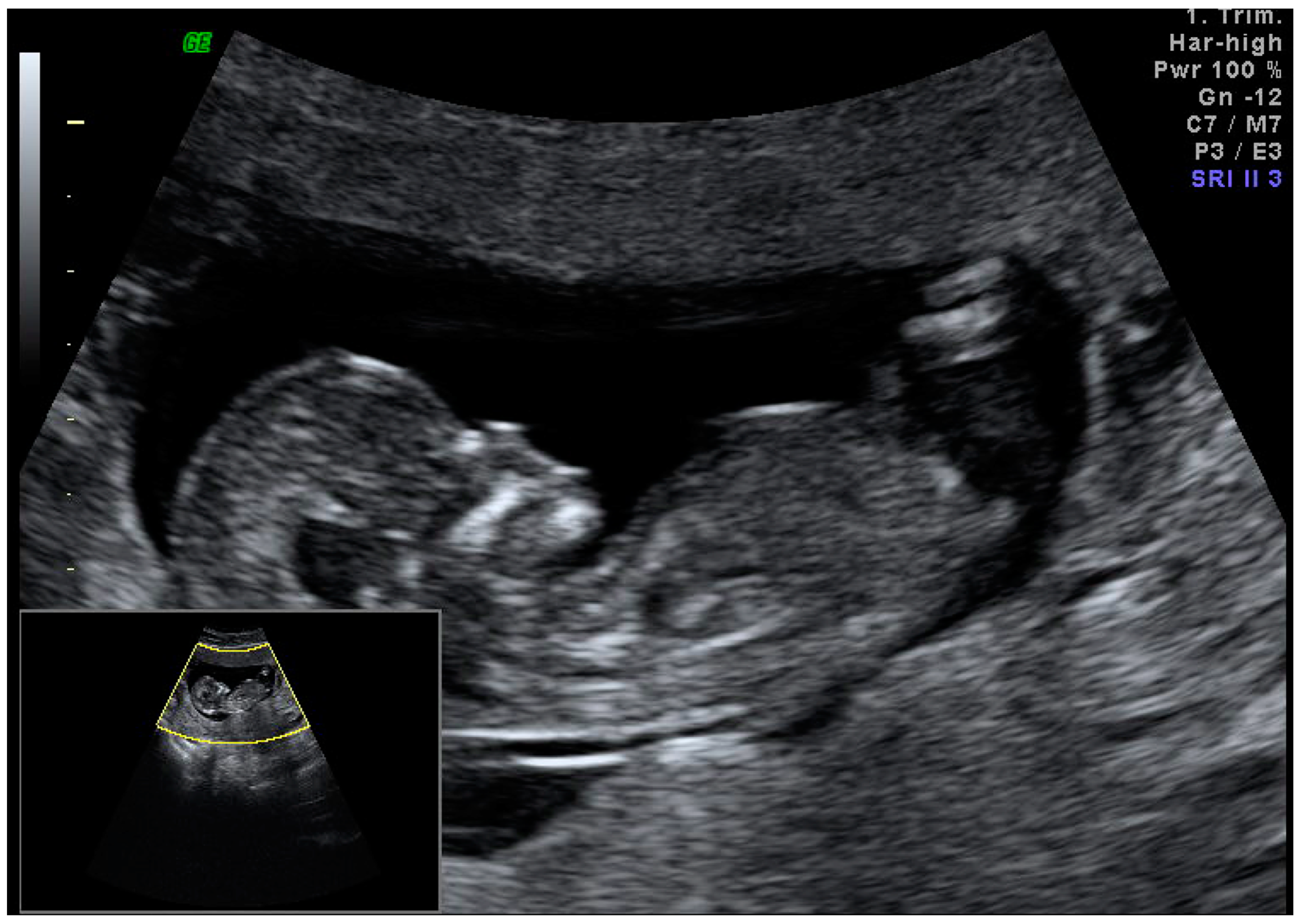 Medicina 59 01803 g009