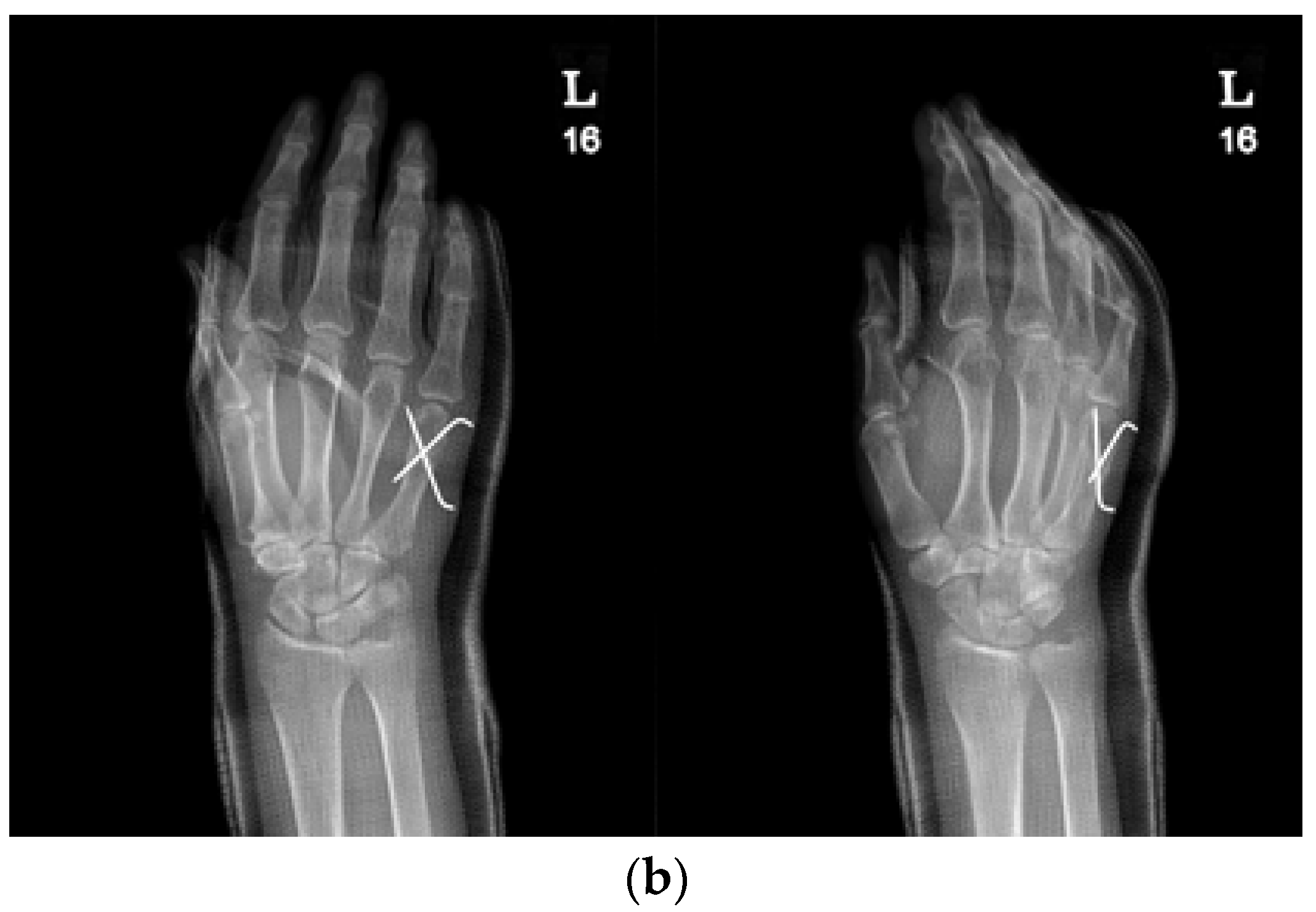 Medicina 59 01944 g001b