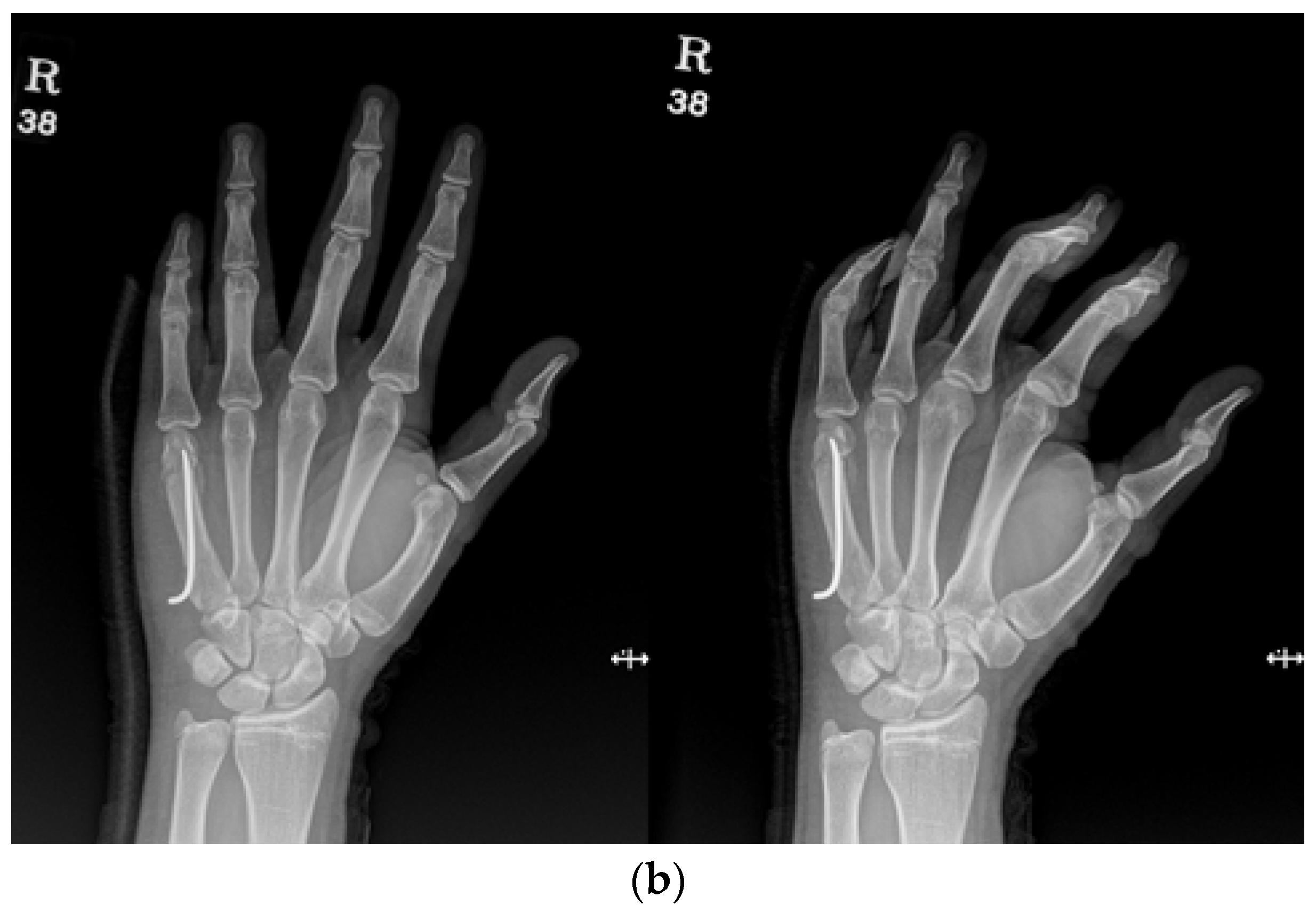 Medicina 59 01944 g002b