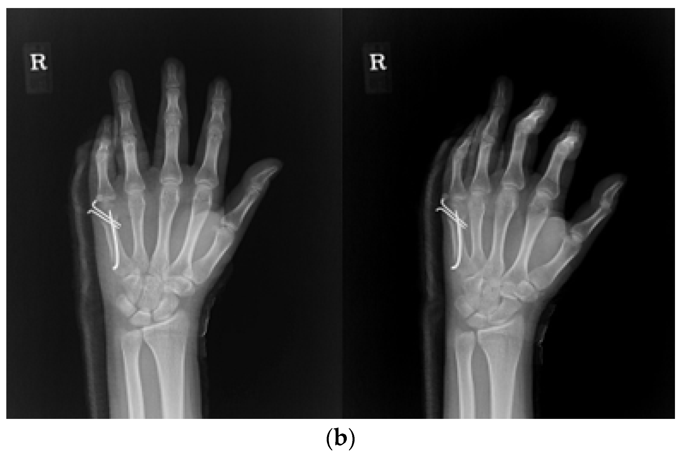 Medicina 59 01944 g003b
