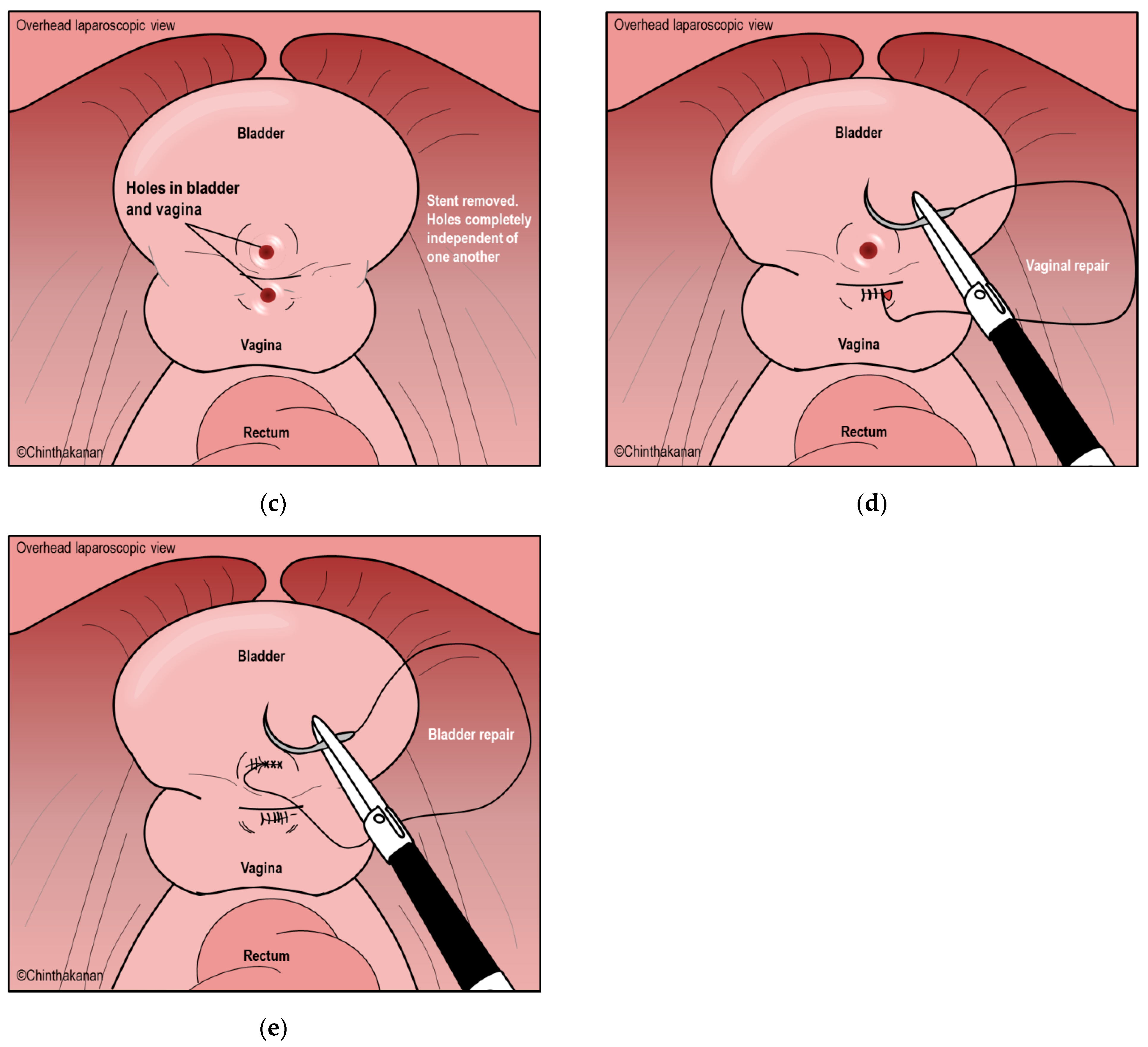 Medicina 59 01947 g004b