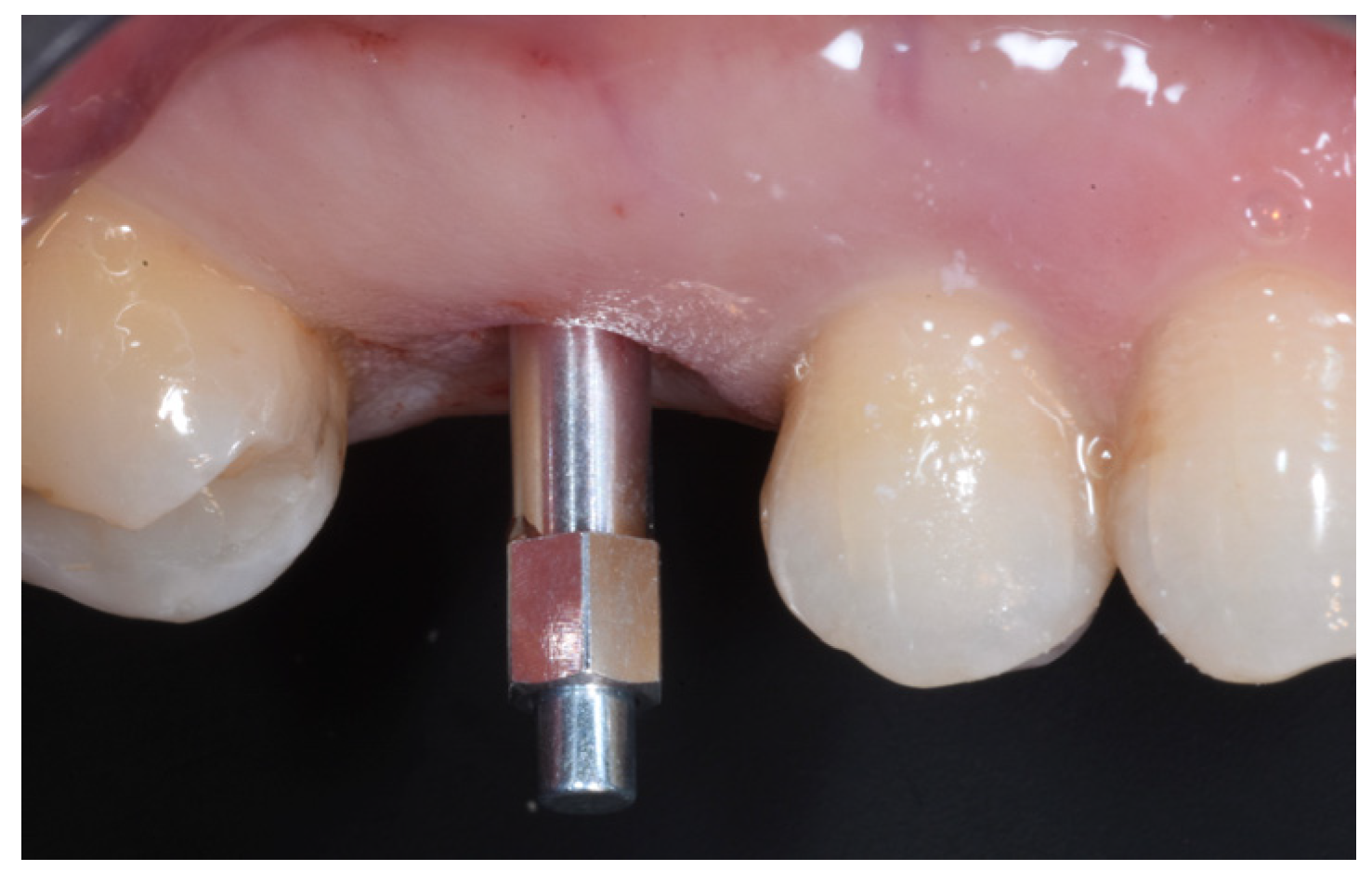 Medicina 59 01978 g011