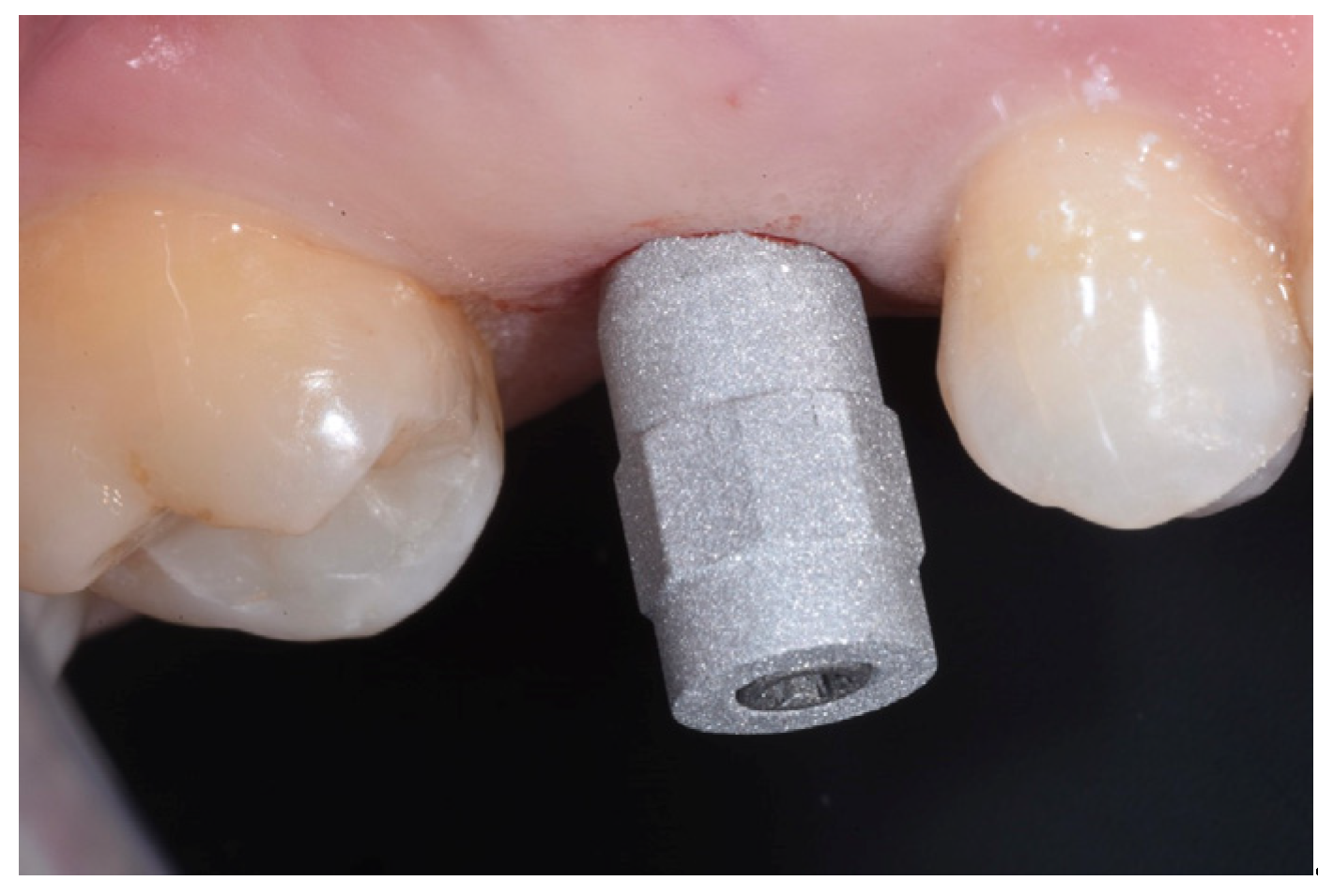 Medicina 59 01978 g012