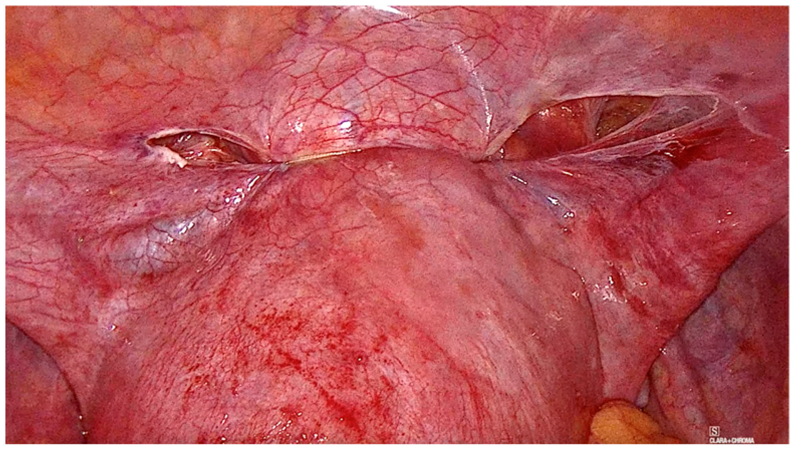 Medicina 59 01979 g002