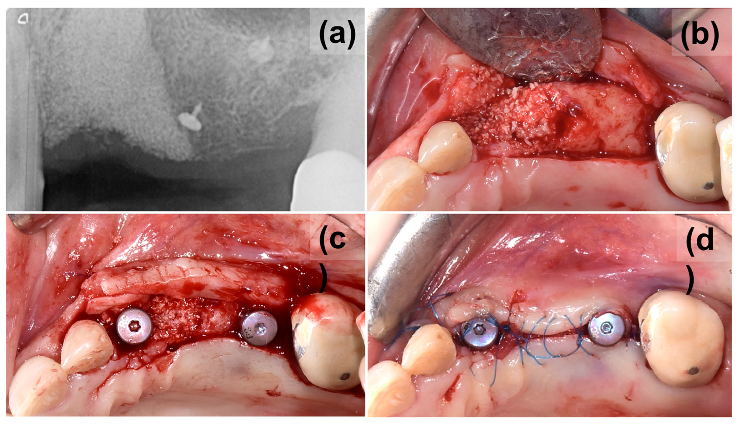 Medicina 59 02009 g003