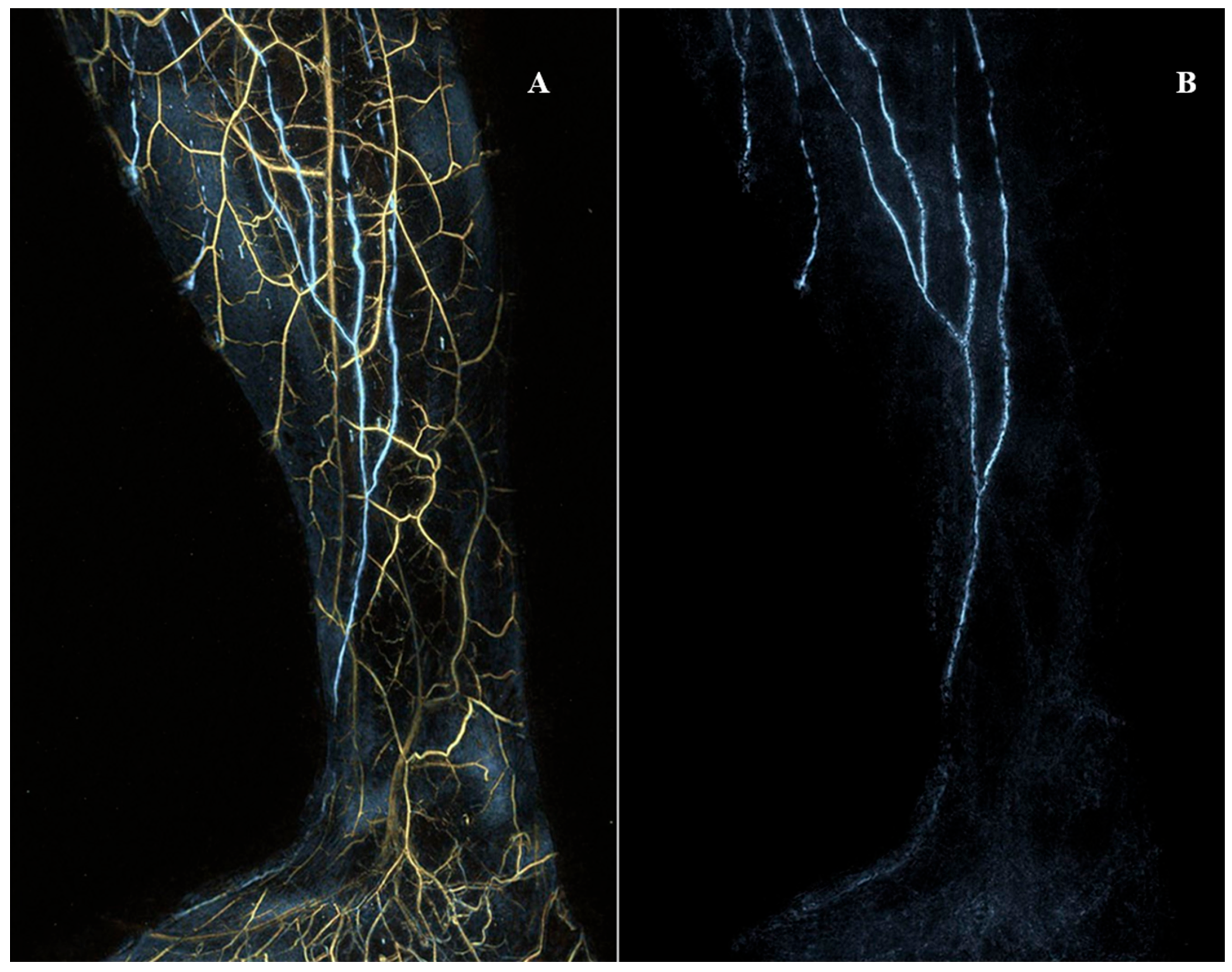 Imaging Modalities for Evaluating Lymphedema | MDPI