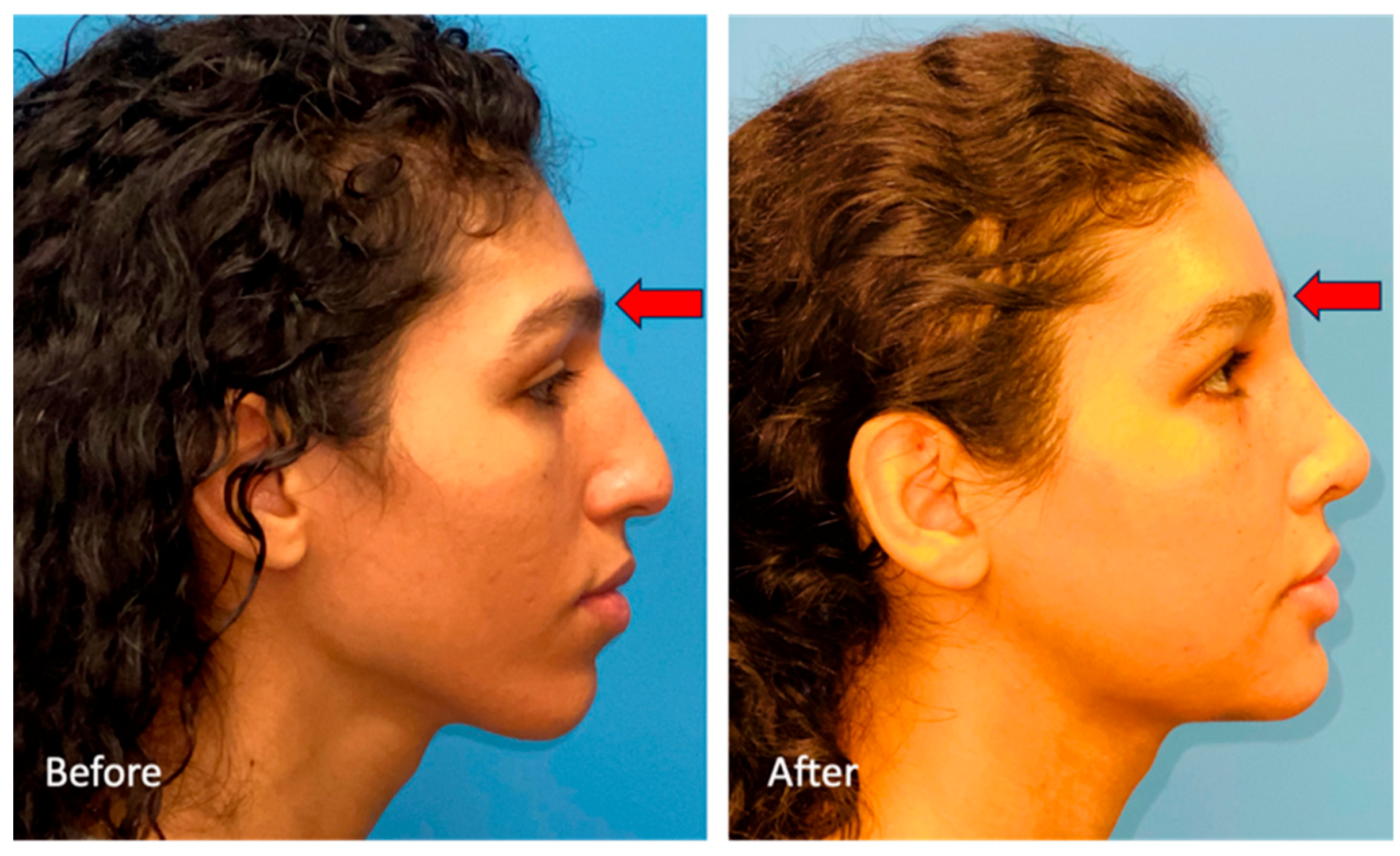 Medicina 59 02070 g004