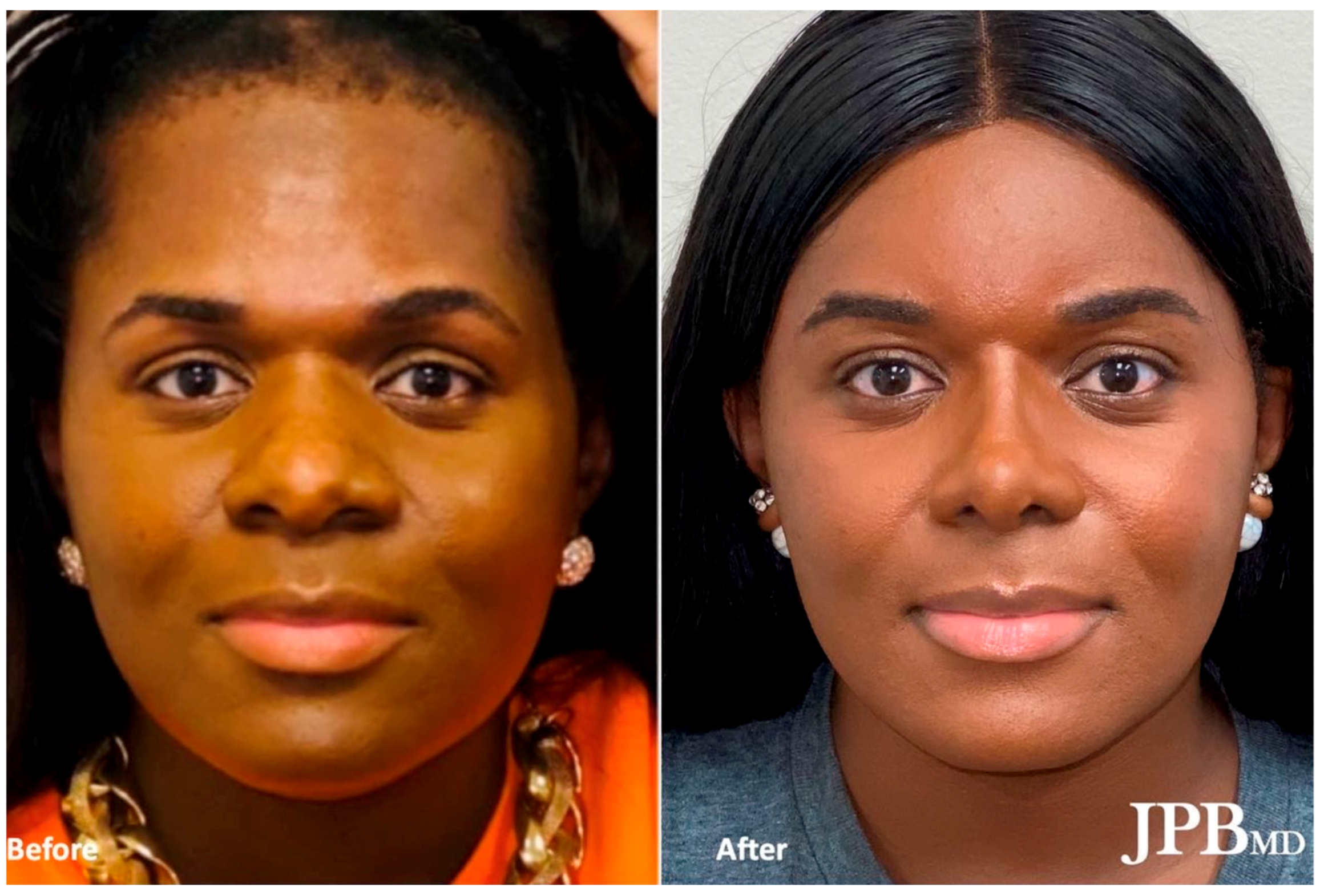 Medicina 59 02070 g005