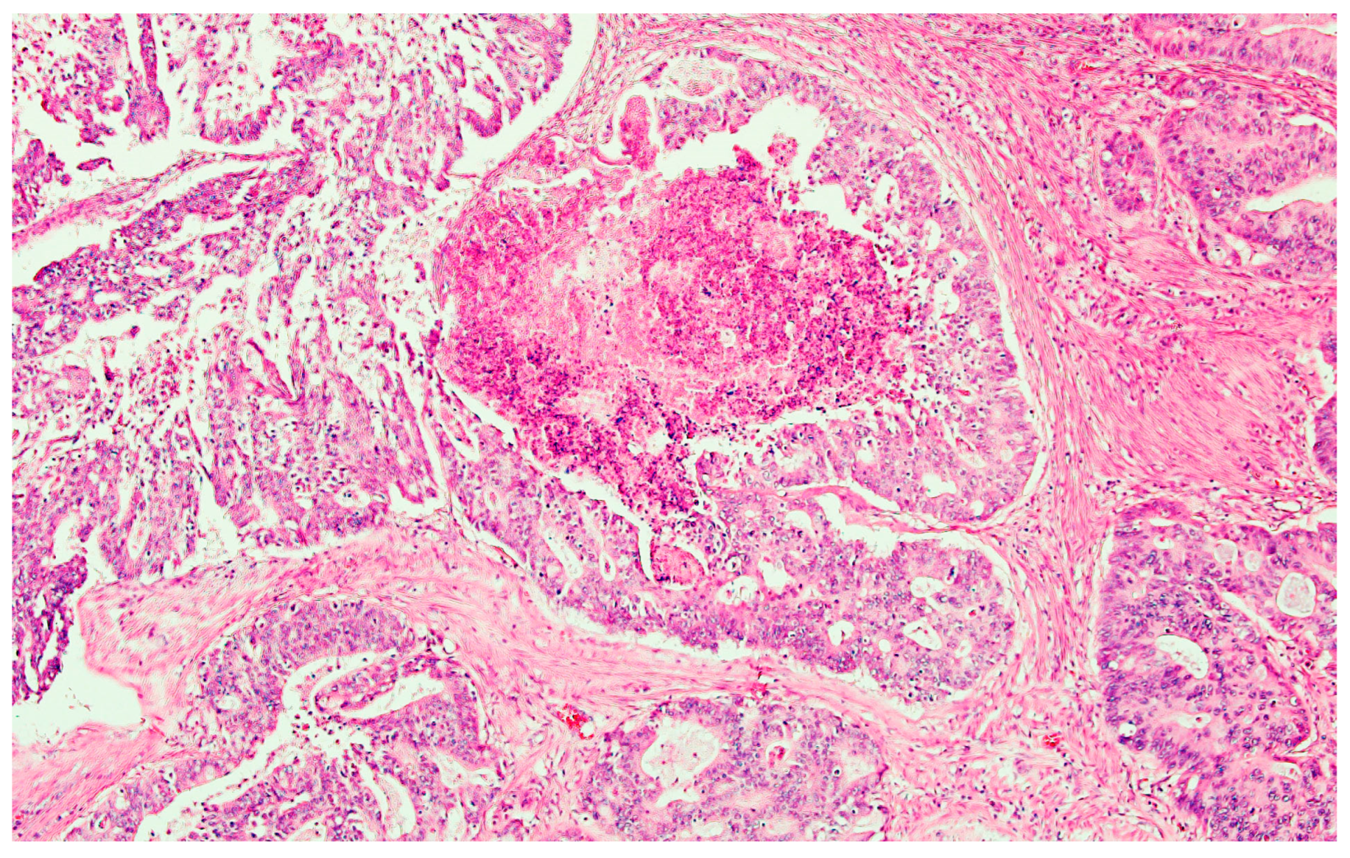 Medicina 59 02076 g006