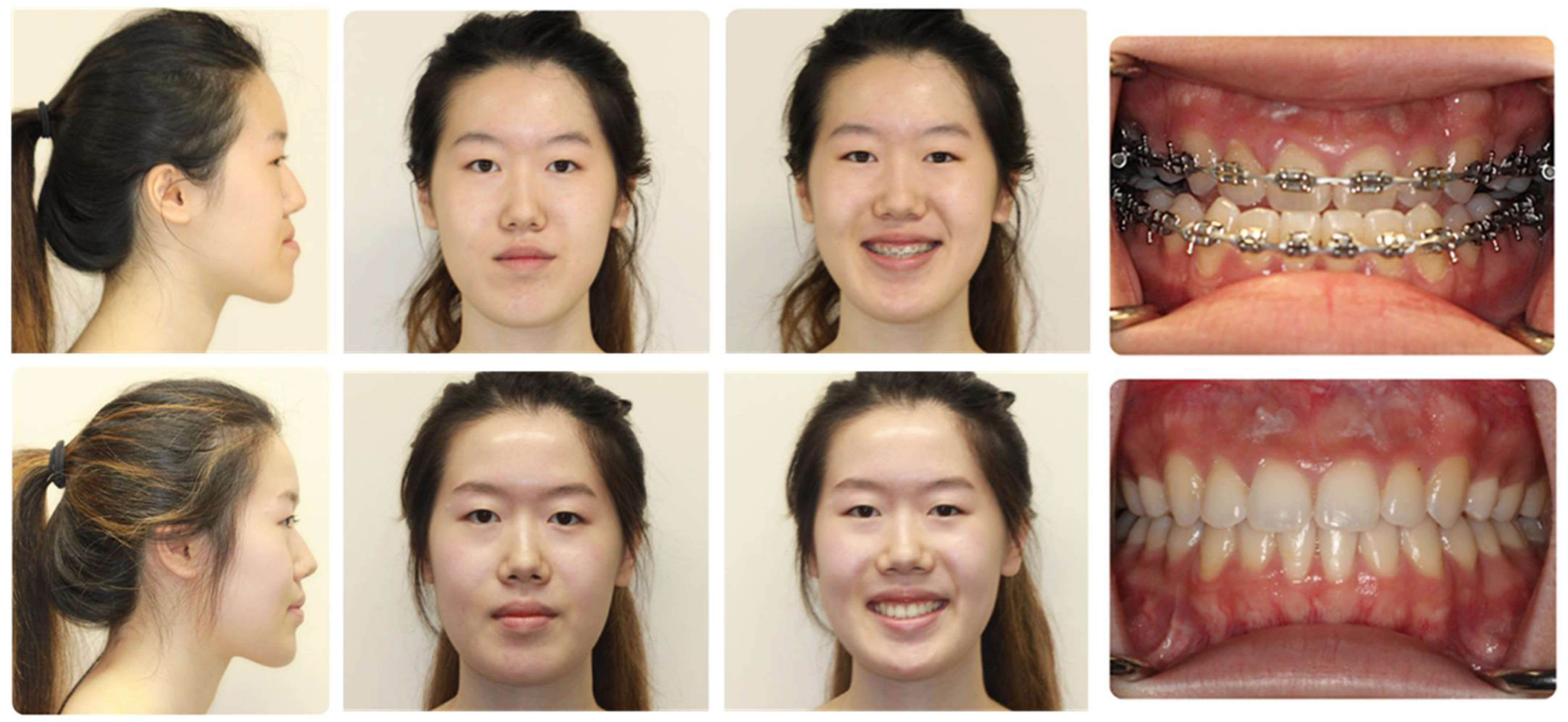 Medicina 59 02100 g004 Medicina 59 02100 g004