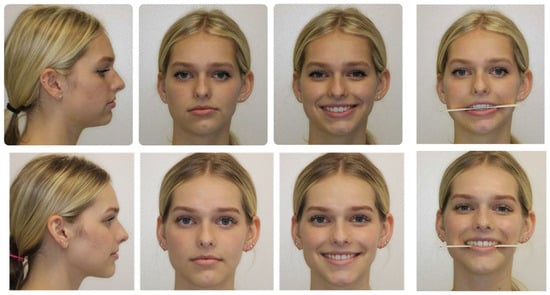 Medicina 59 02100 g006