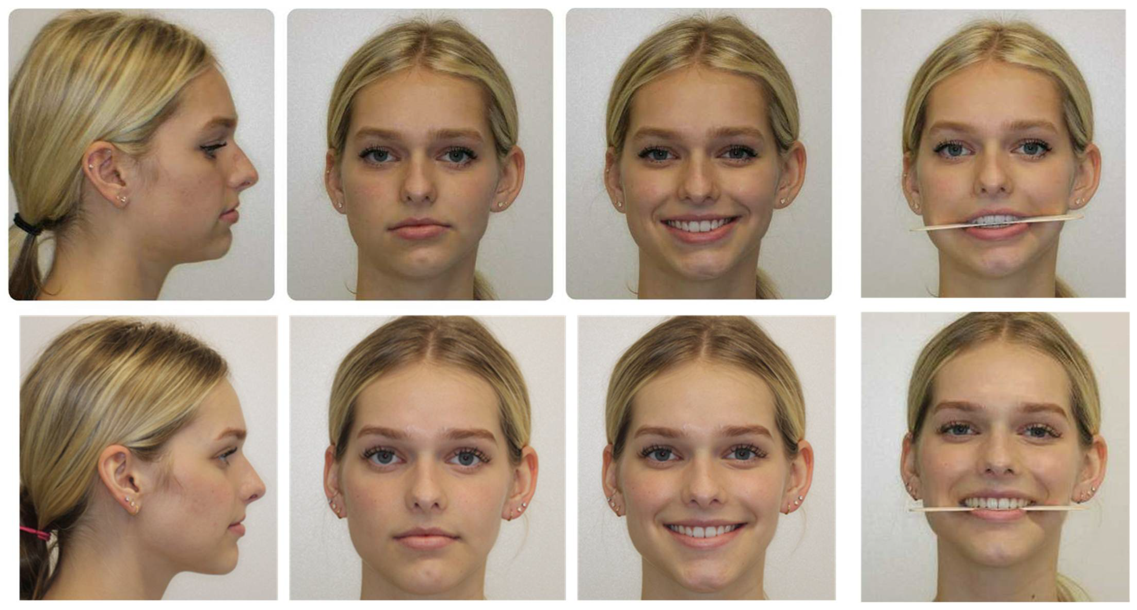 Medicina 59 02100 g006 Medicina 59 02100 g006