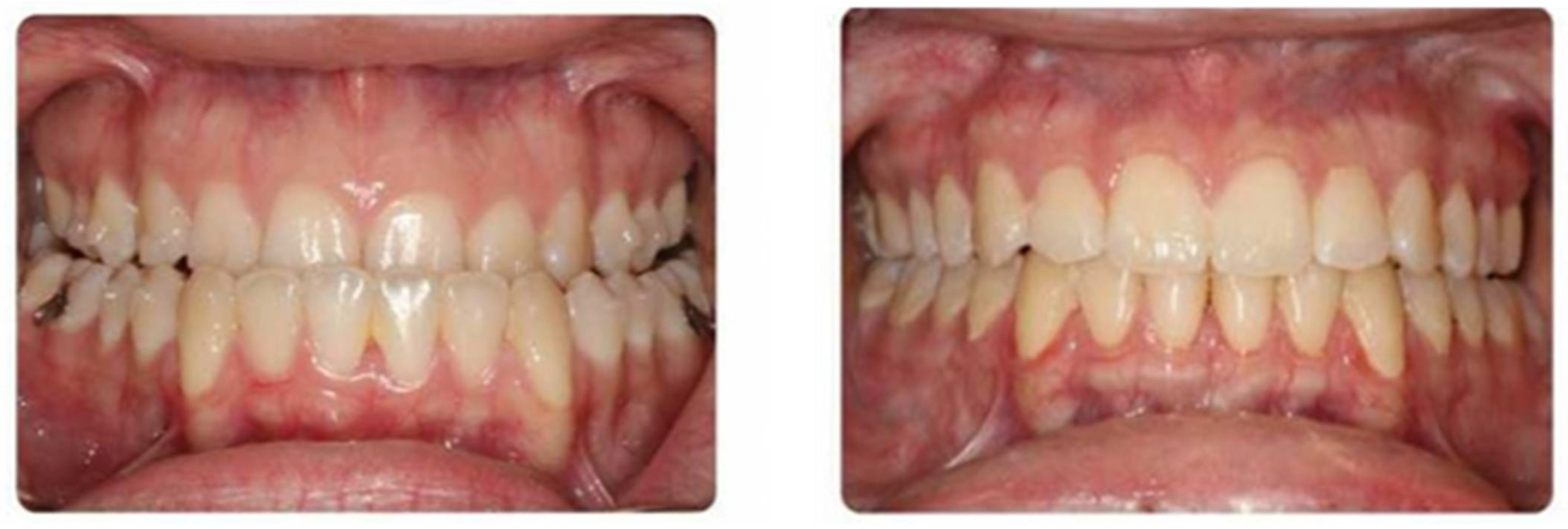 Medicina 59 02100 g007 Medicina 59 02100 g007