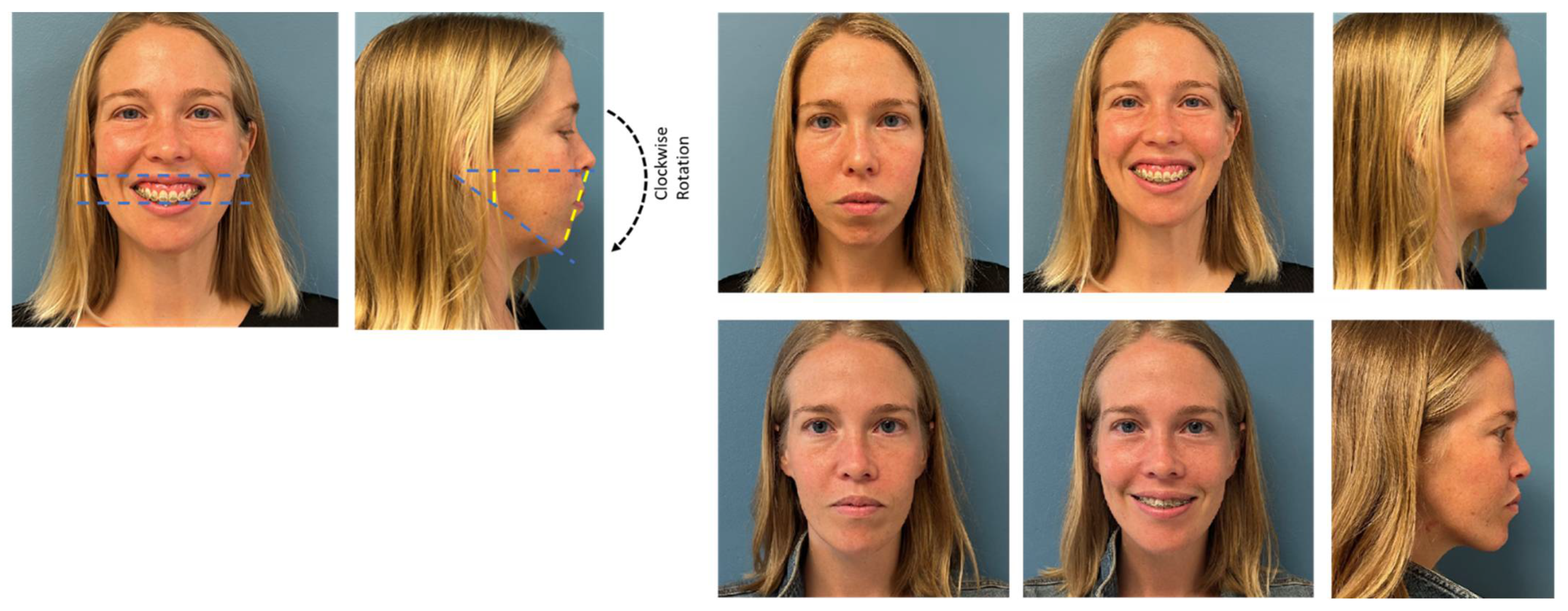 Medicina 59 02100 g009 Medicina 59 02100 g009
