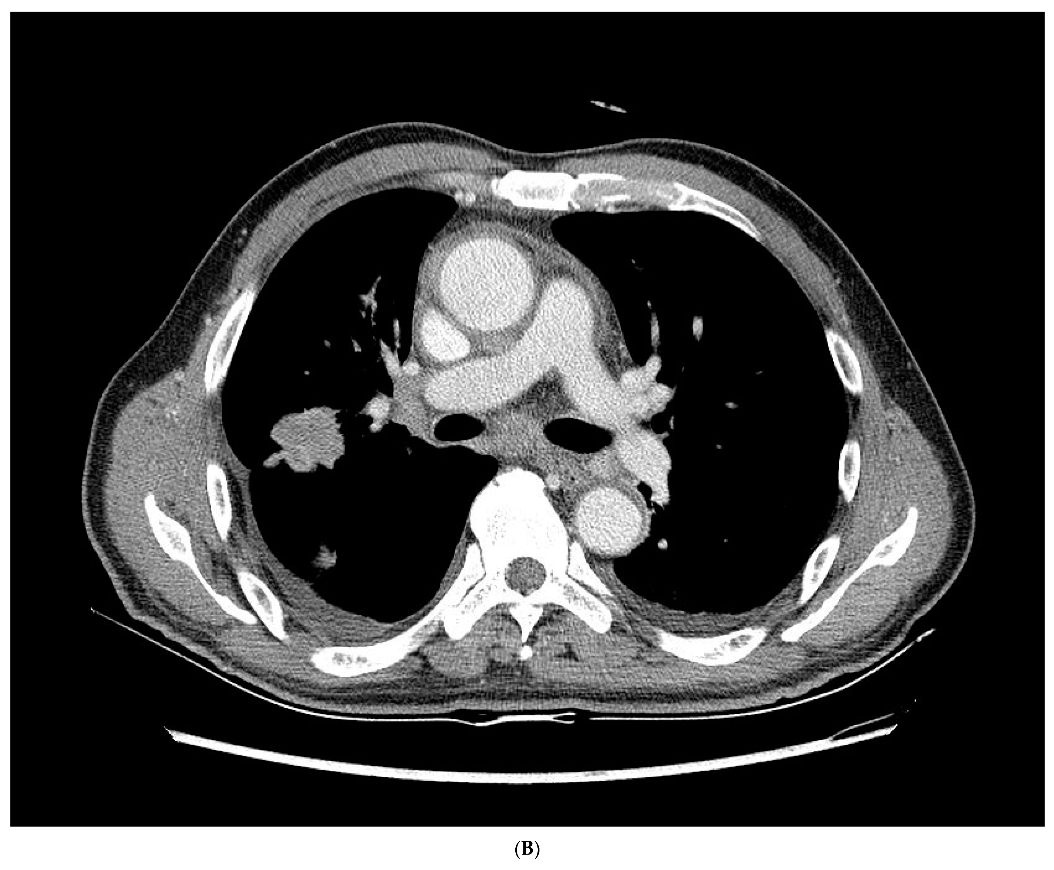 Medicina 59 02144 g001b