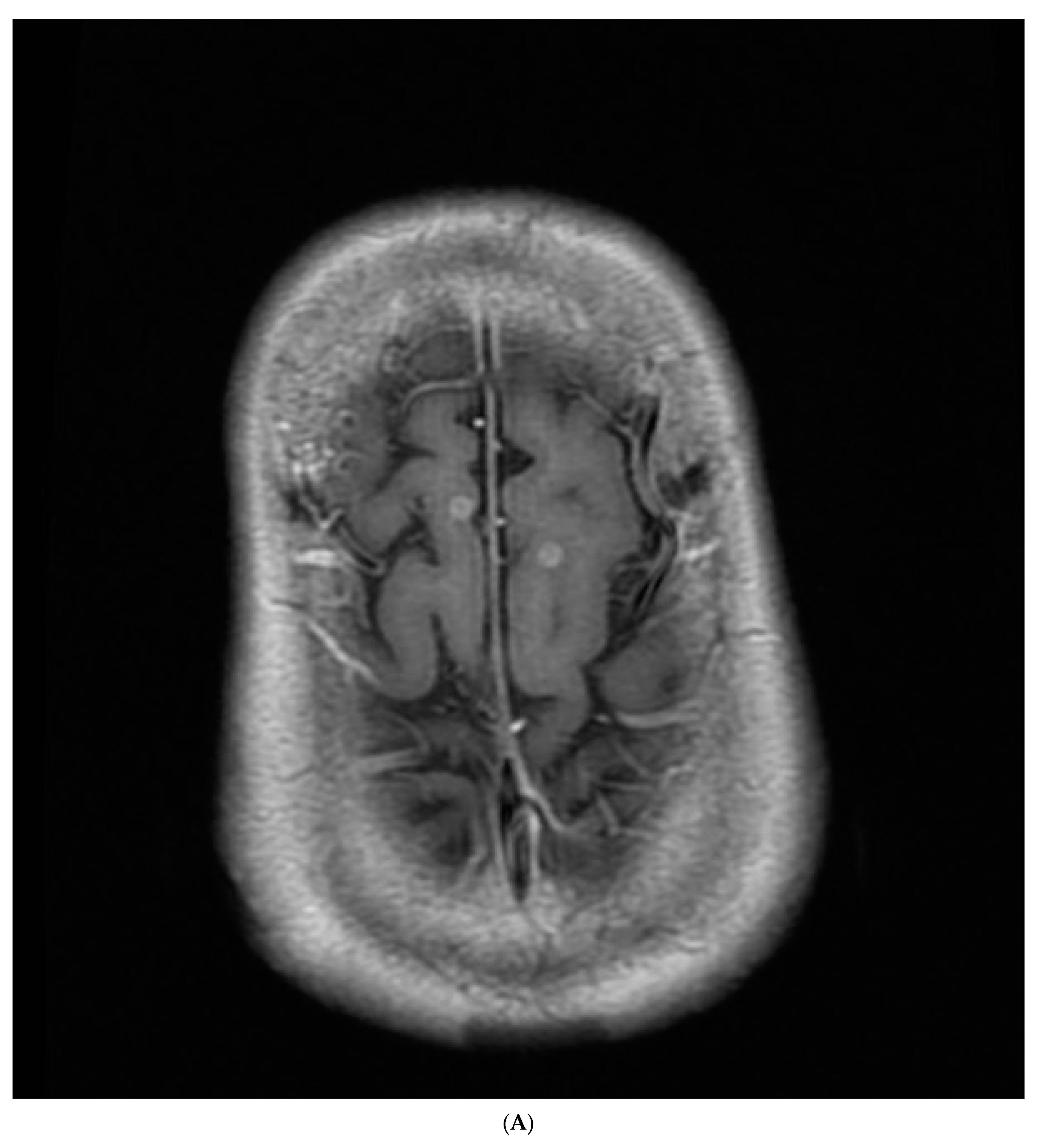 Medicina 59 02144 g003a