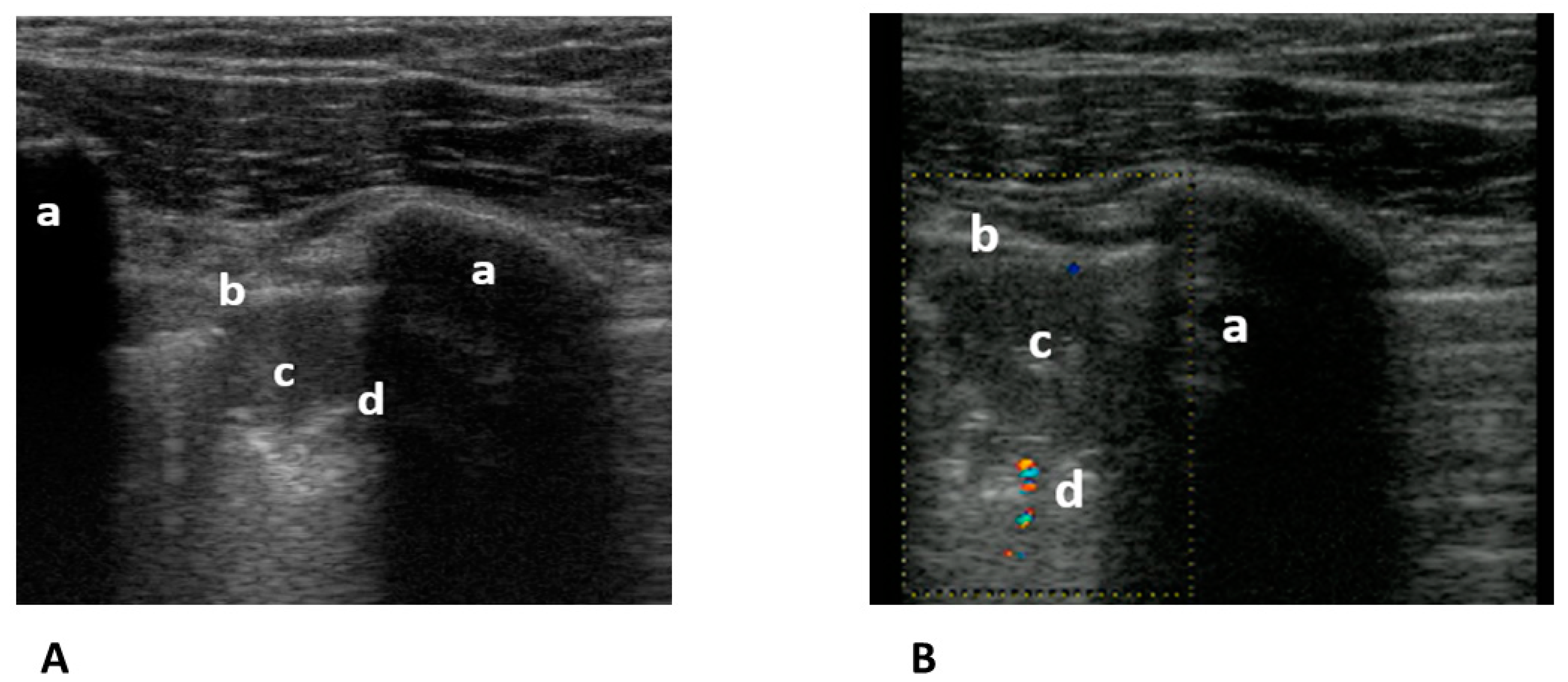 Medicina 59 02179 g006