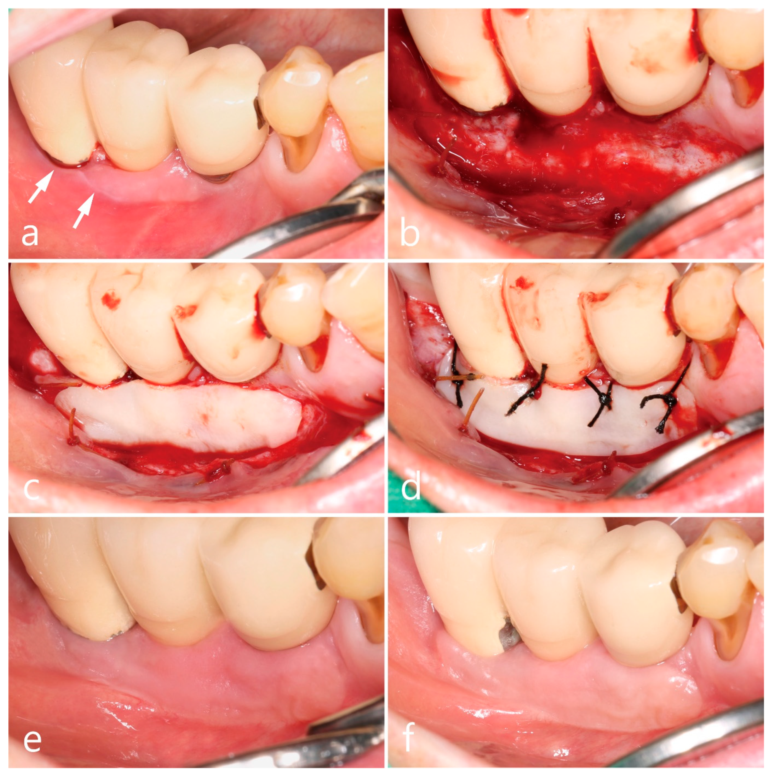 Medicina 59 02188 g002