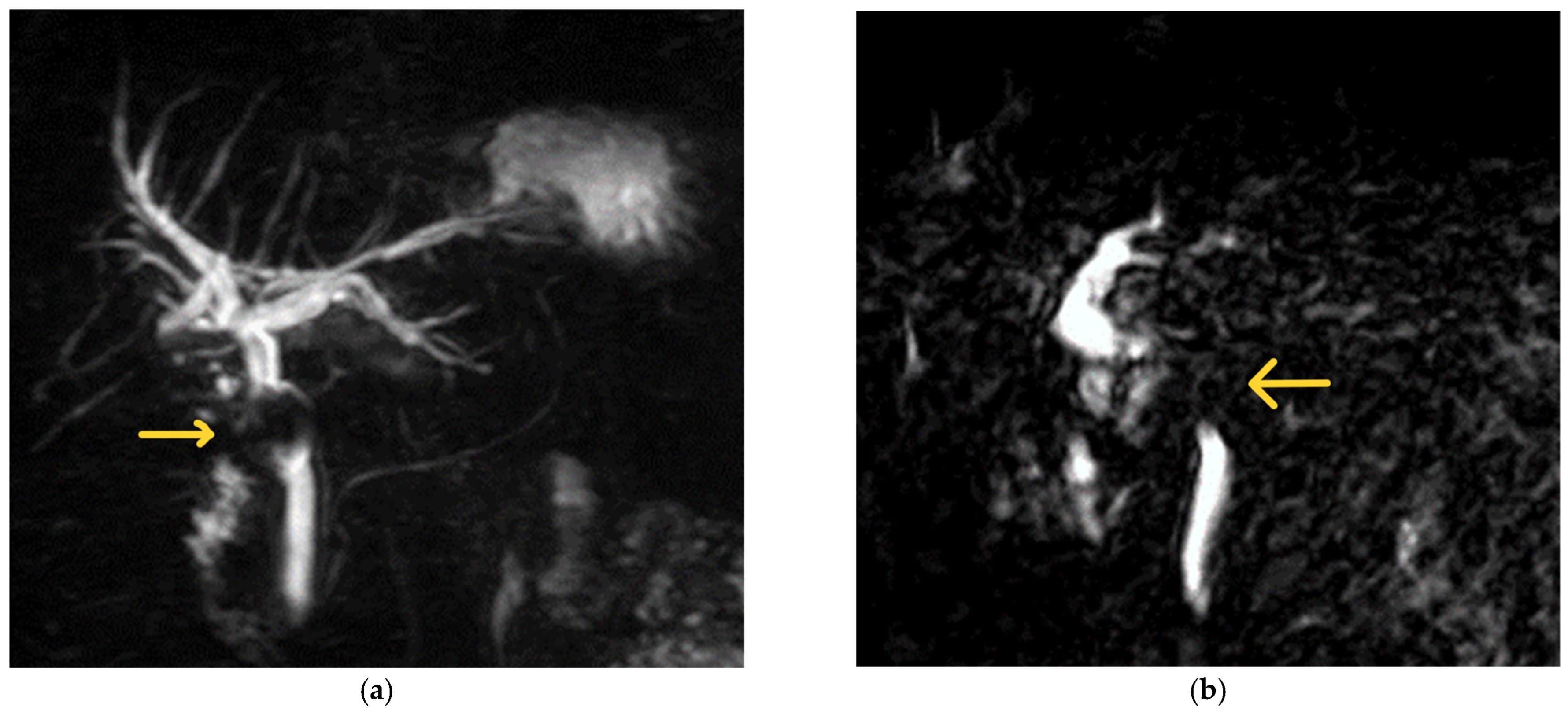 Medicina 60 00012 g002