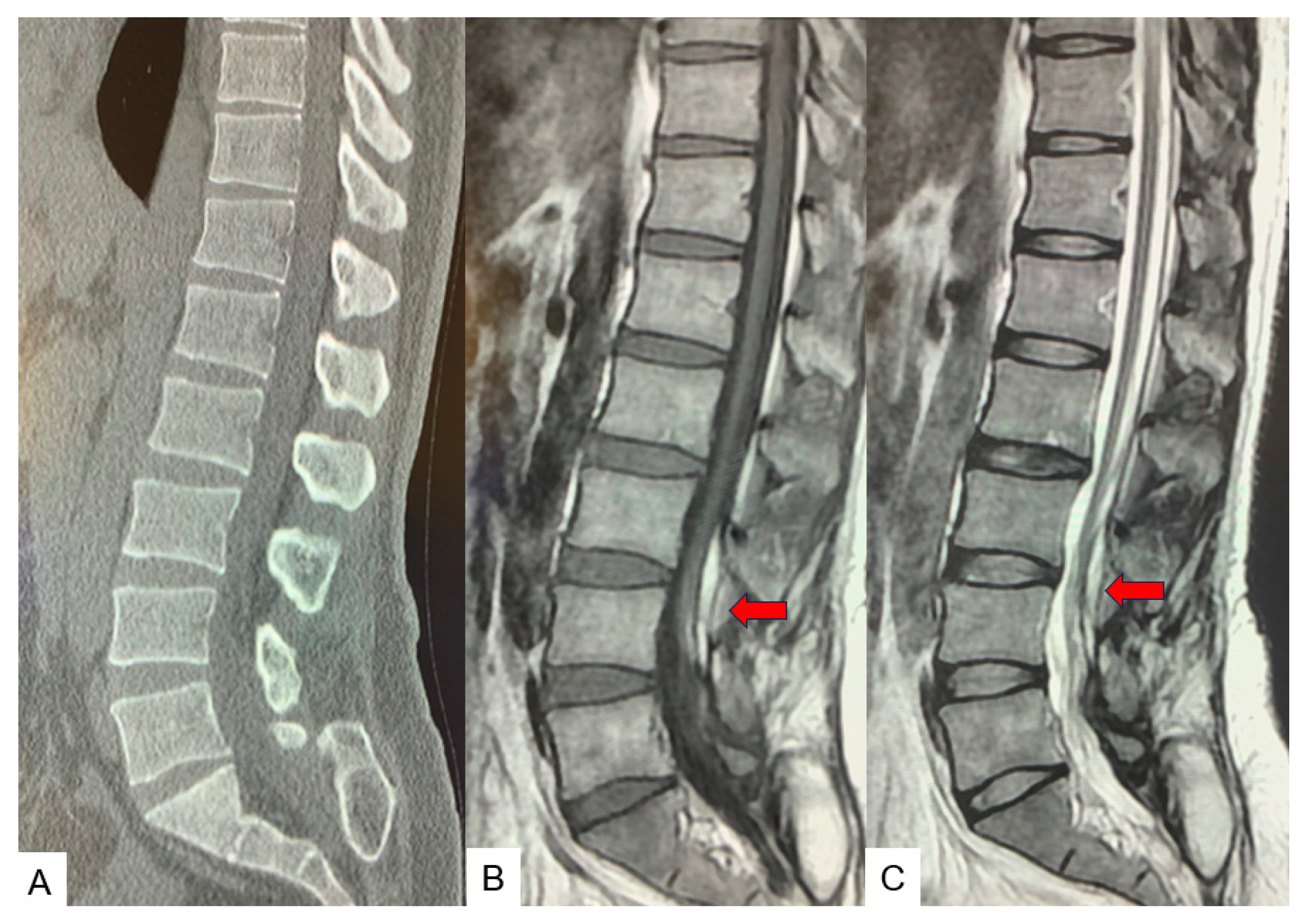 Medicina 60 00020 g012