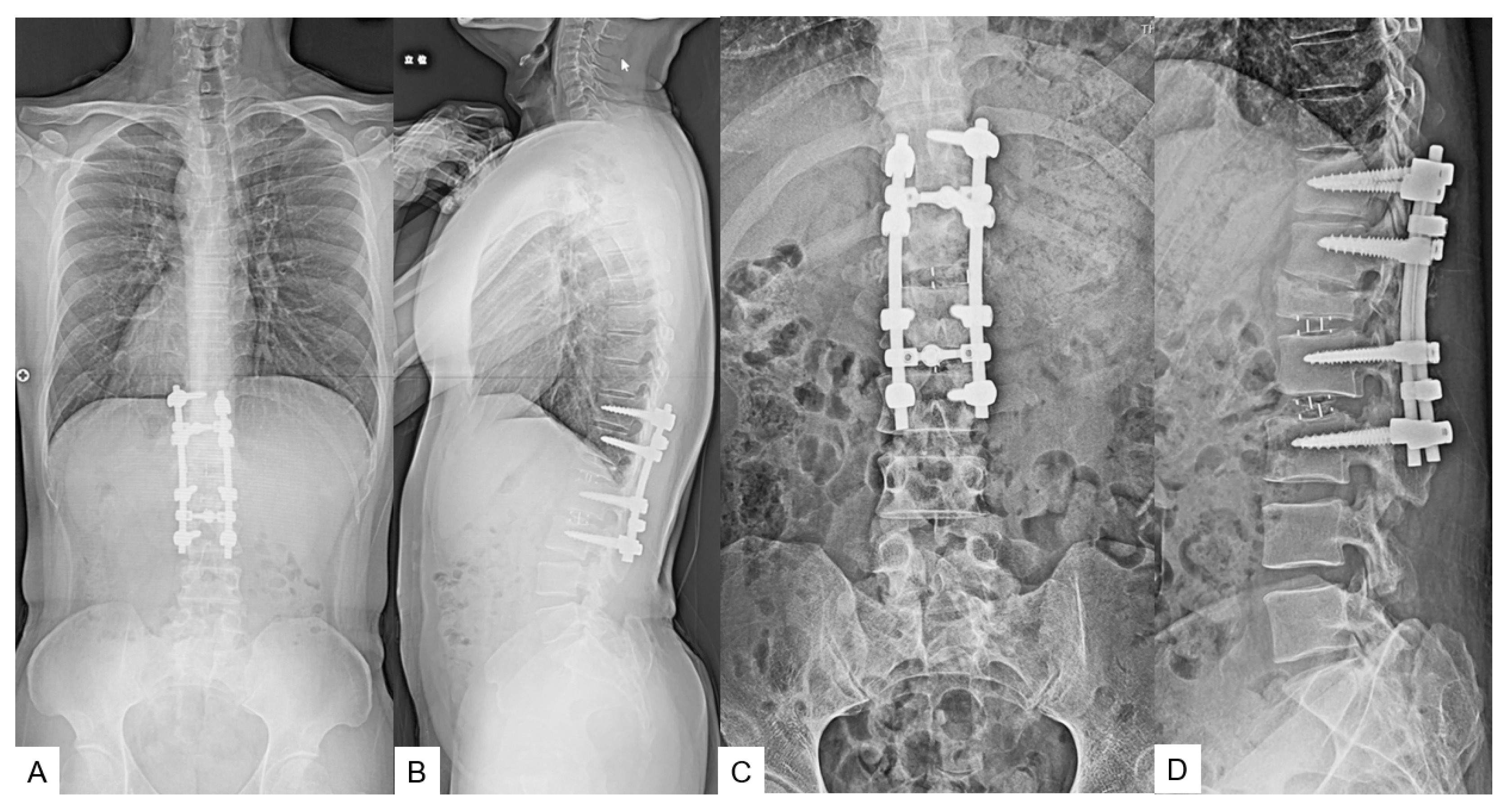 Medicina 60 00020 g014