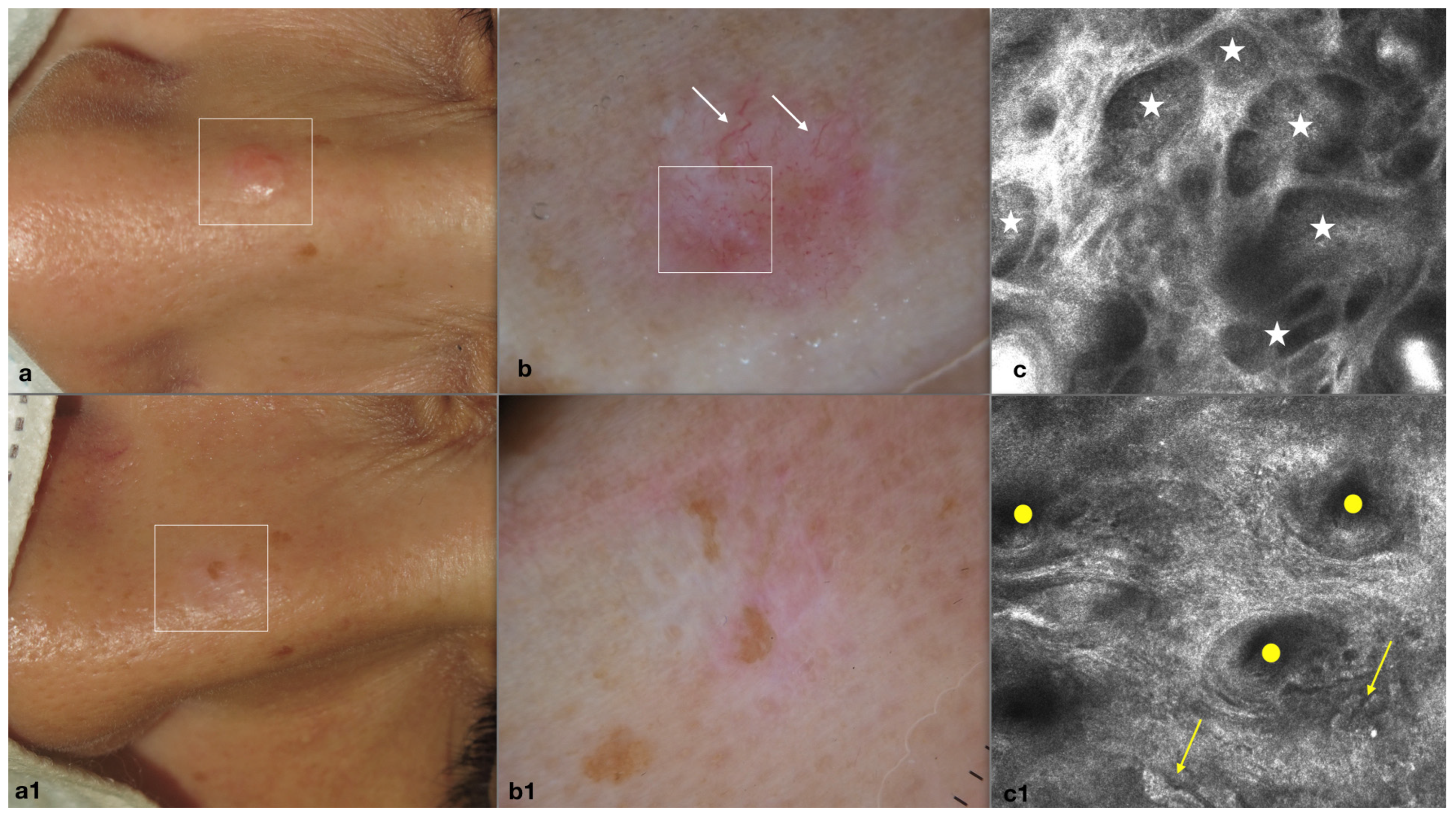Medicina 60 00030 g001