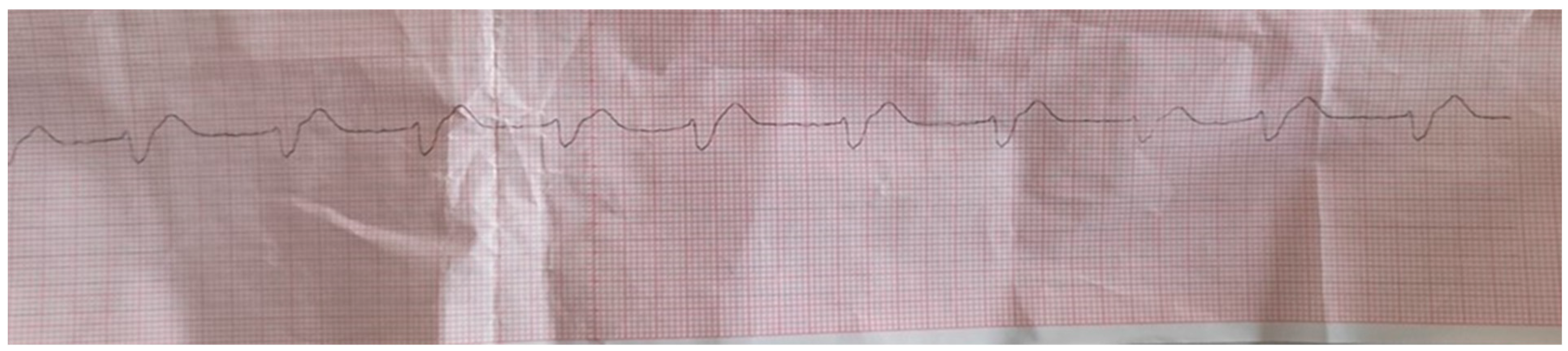 Medicina 60 00039 g002 Medicina 60 00039 g002