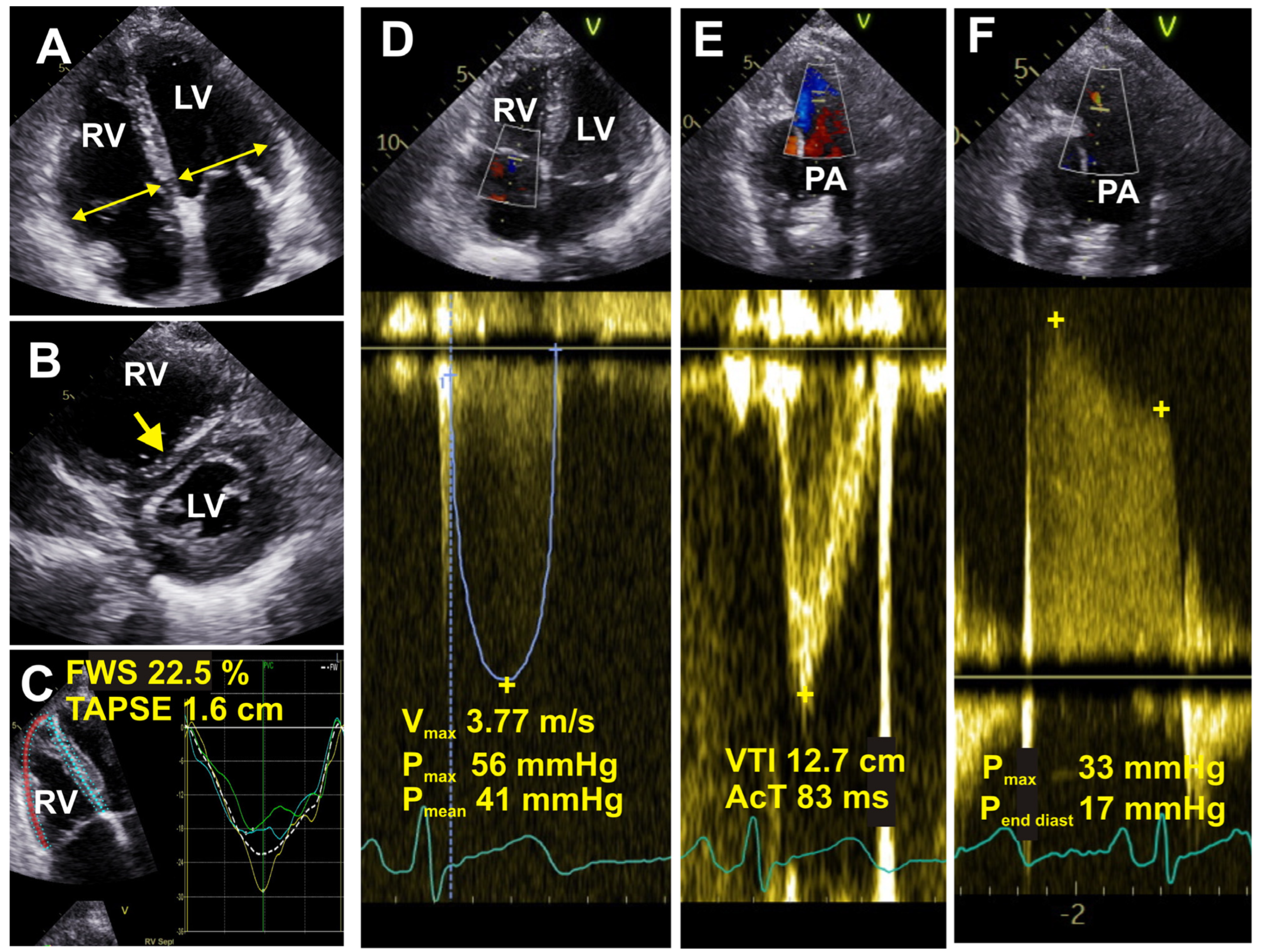 Medicina 60 00058 g002 Medicina 60 00058 g002
