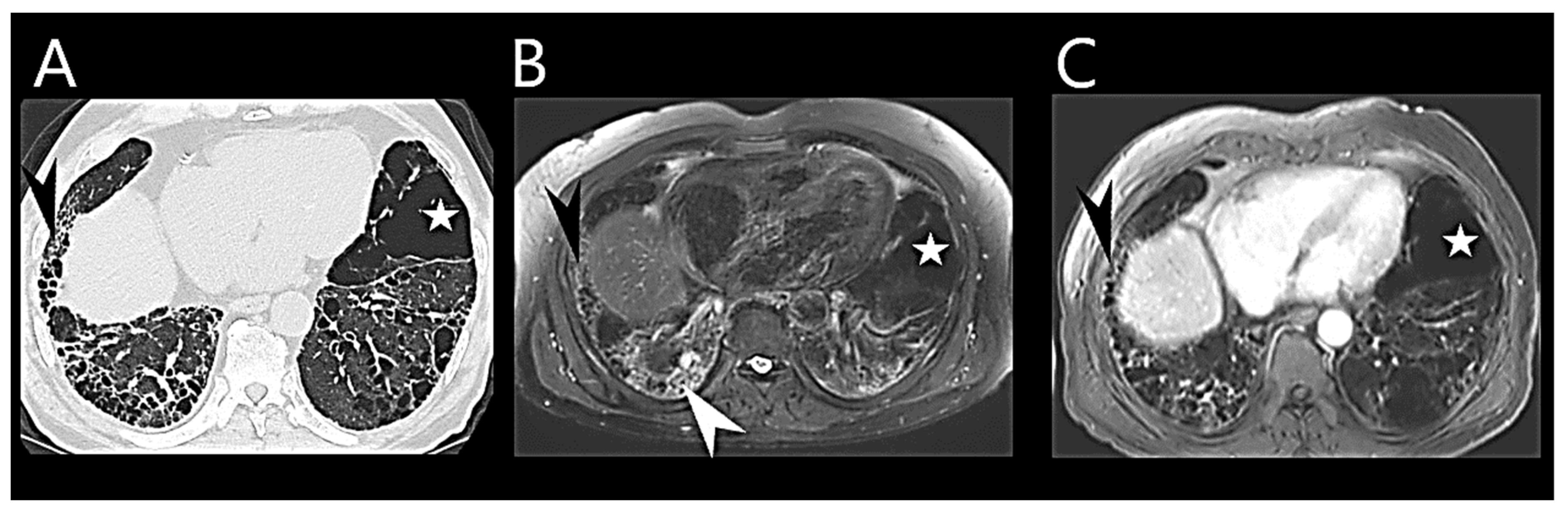 Medicina 60 00058 g004 Medicina 60 00058 g004