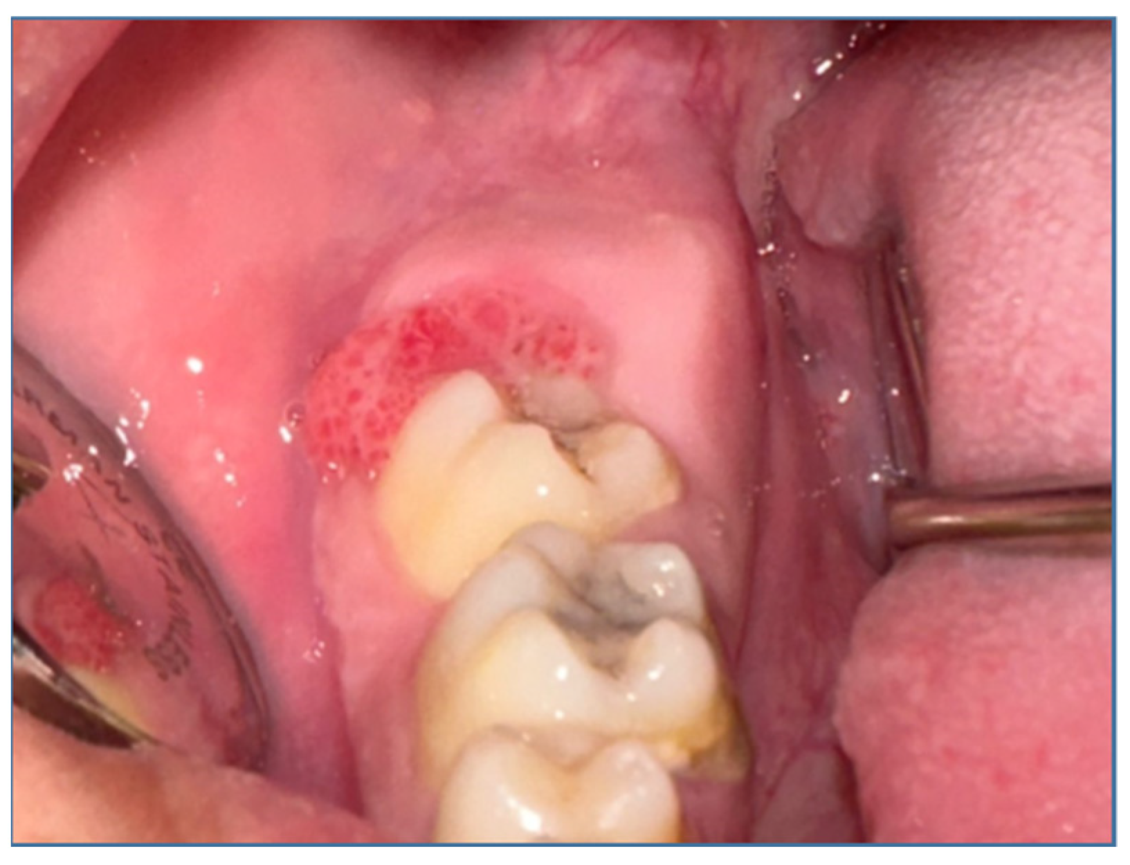 Medicina 60 00066 g002