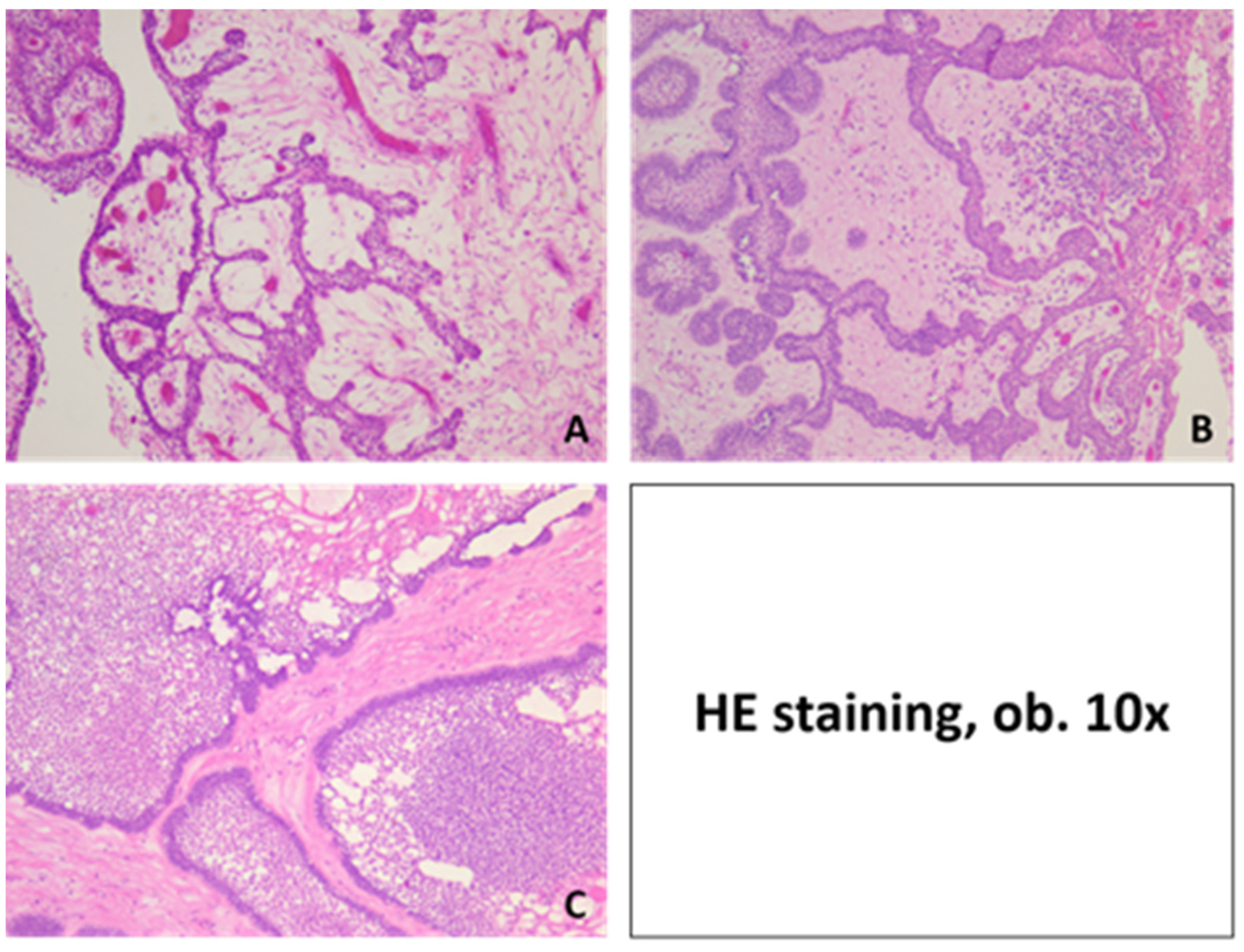 Medicina 60 00066 g005