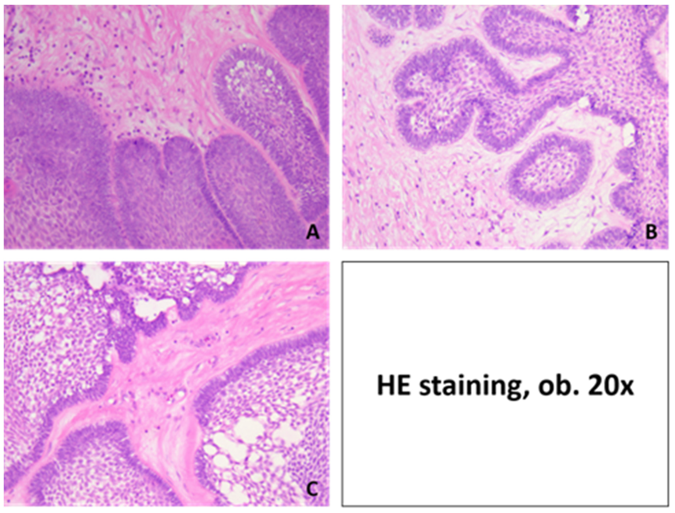 Medicina 60 00066 g006