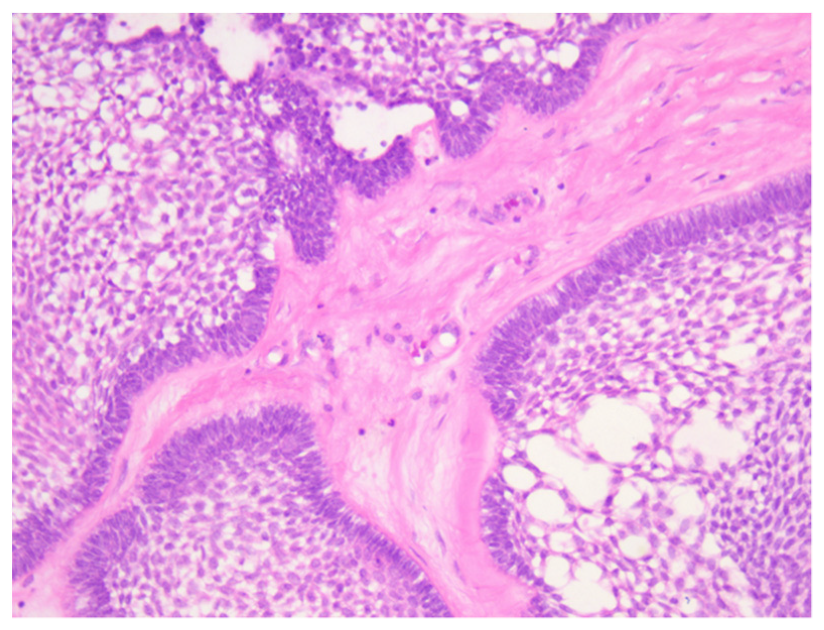 Medicina 60 00066 g007