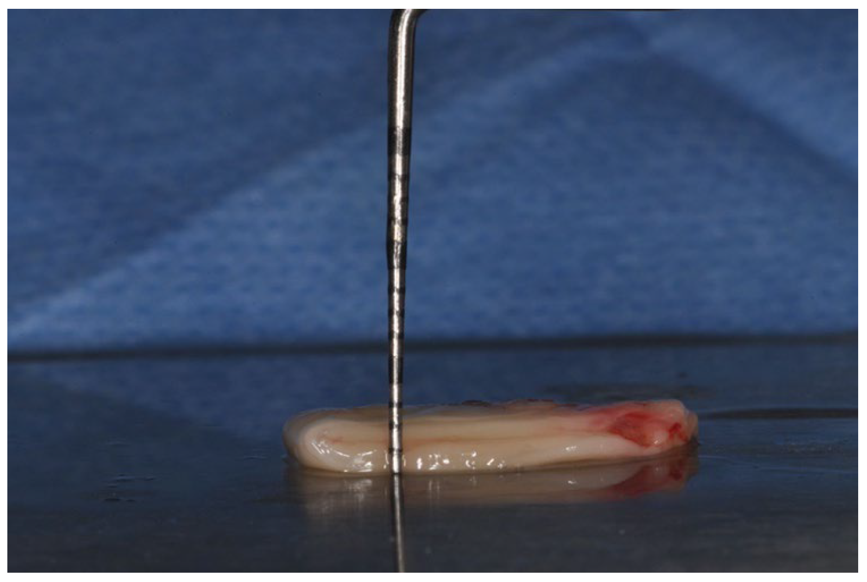 Medicina 60 00096 g001