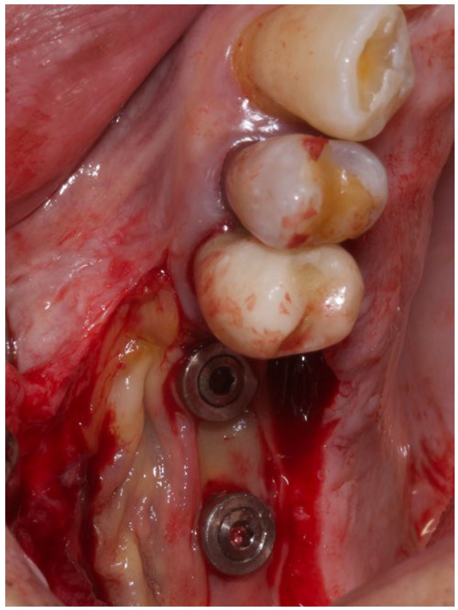 Medicina 60 00096 g003