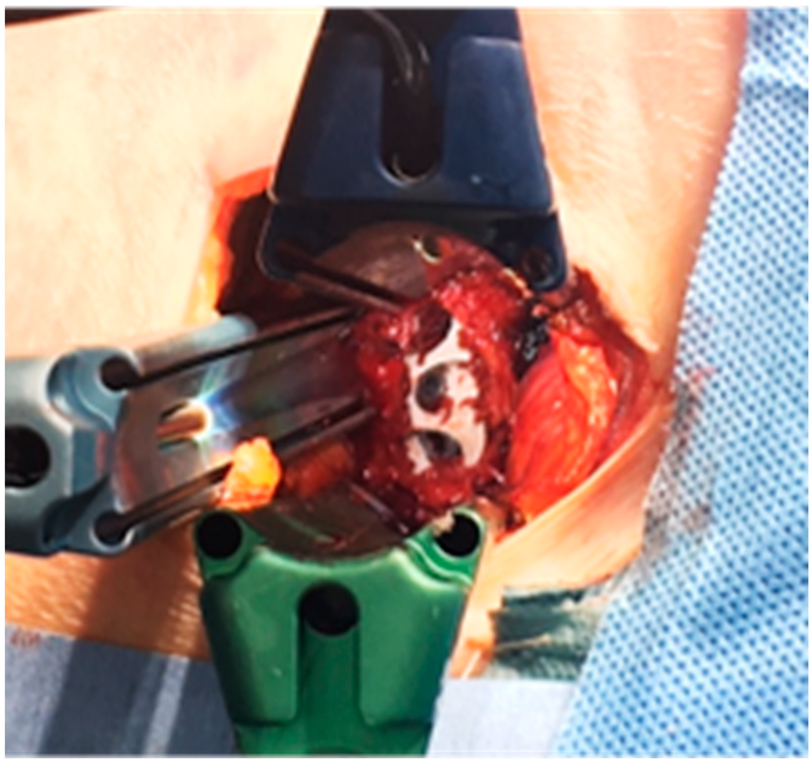 Medicina 60 00107 g002