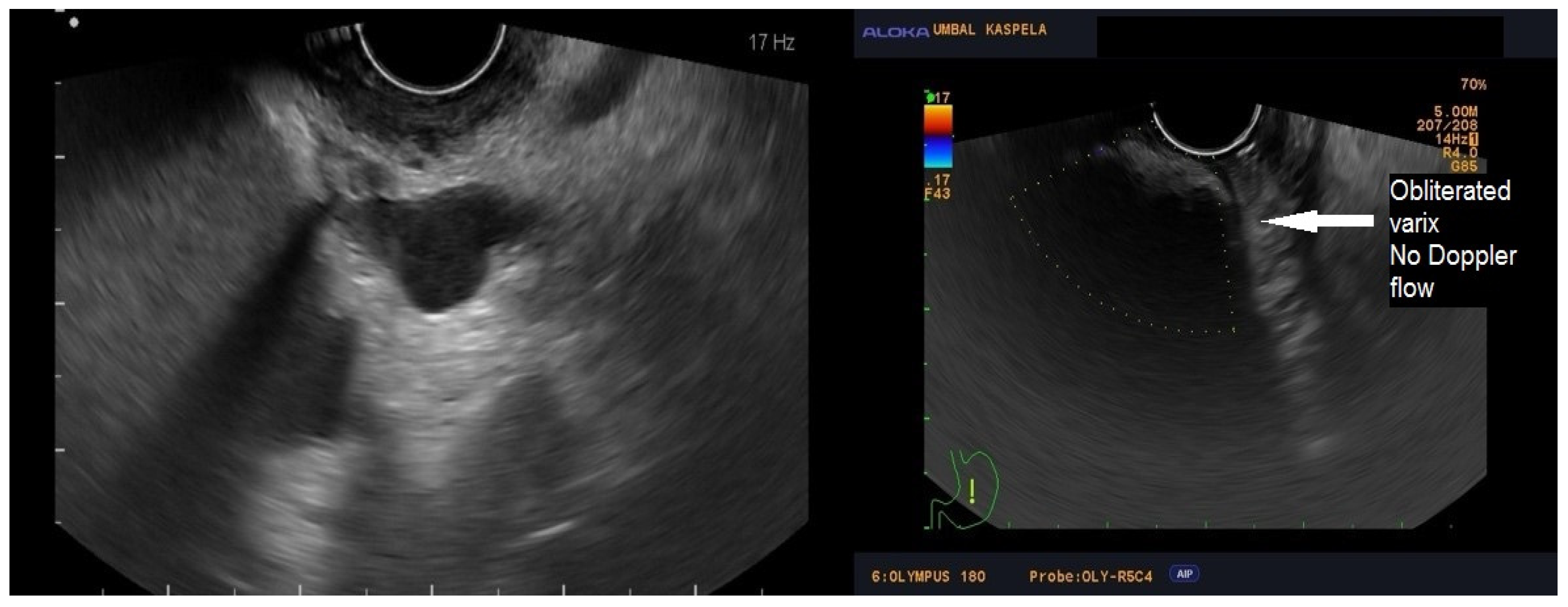 Medicina 60 00116 g002
