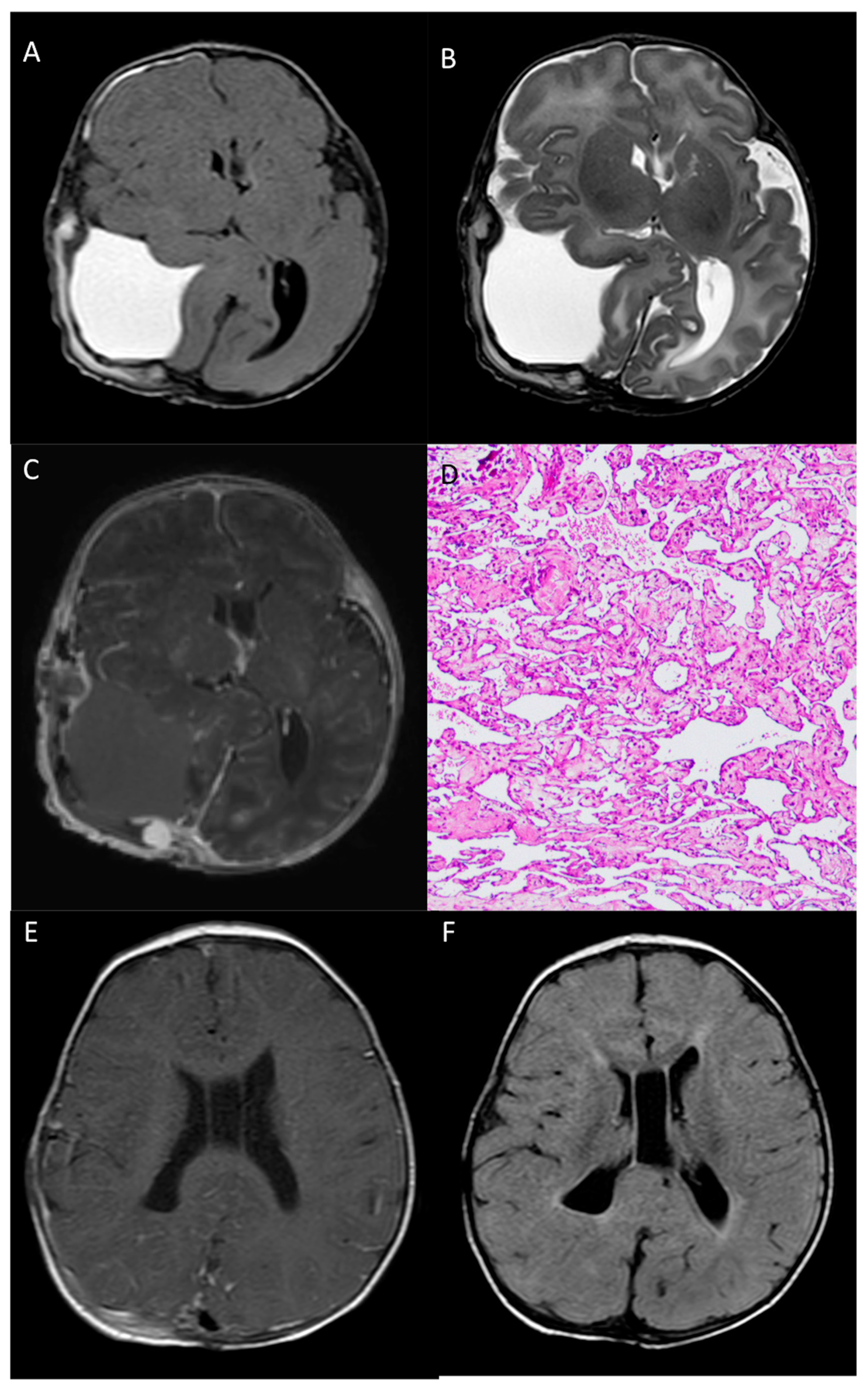 Medicina 60 00145 g004