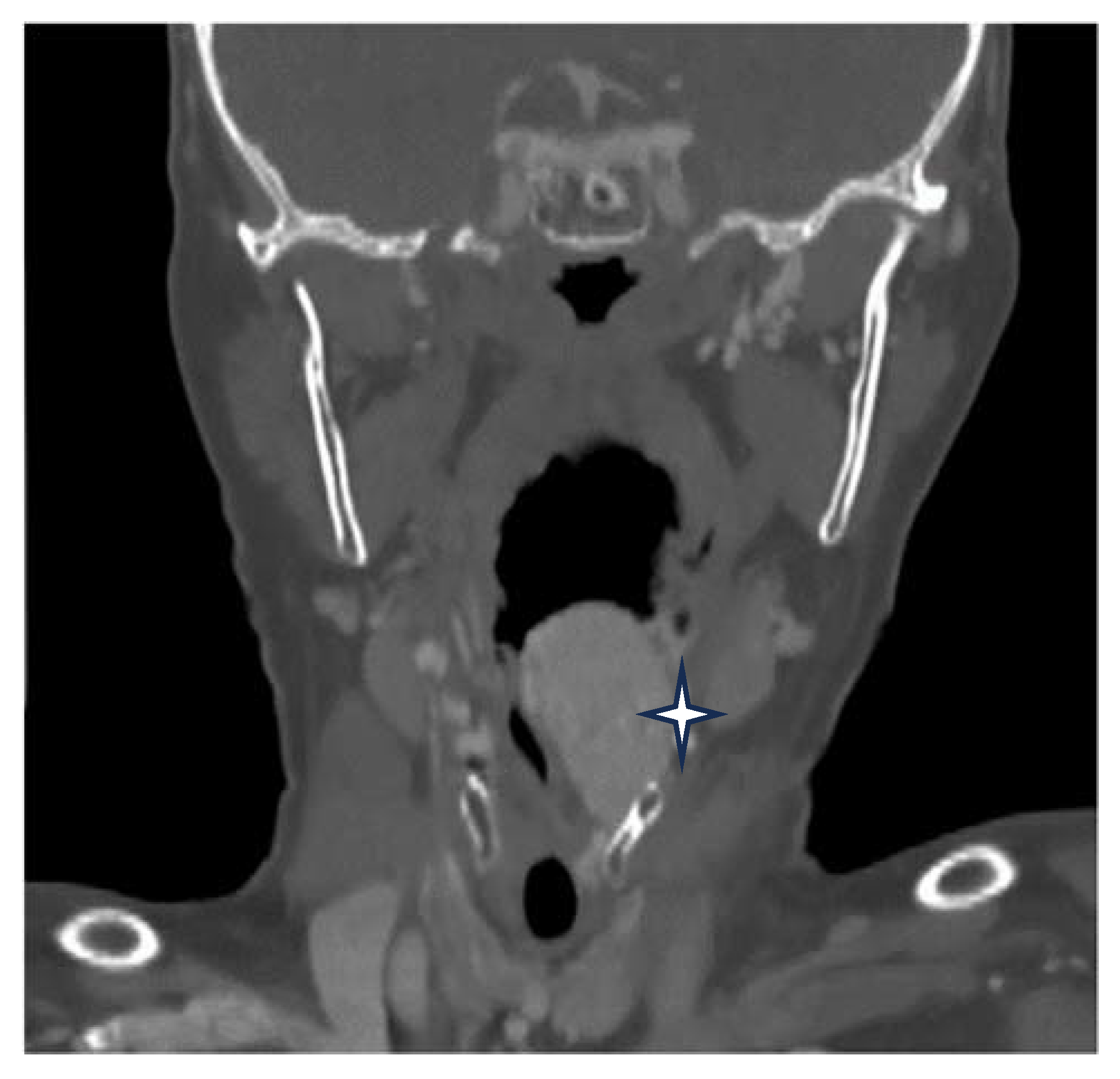 Medicina 60 00198 g002 Medicina 60 00198 g002