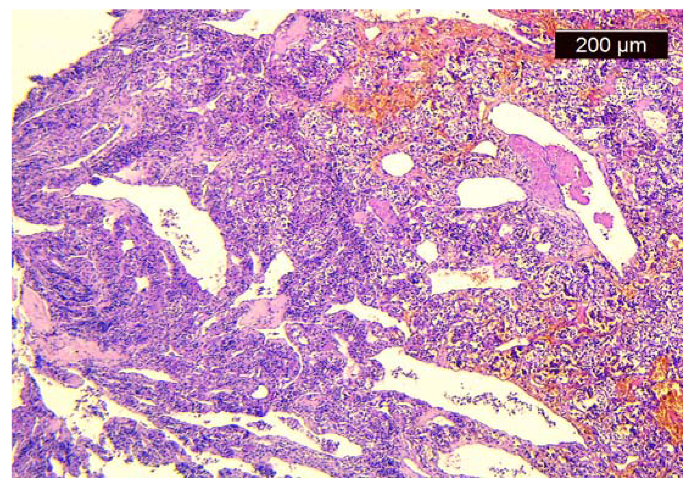 Medicina 60 00198 g003 Medicina 60 00198 g003