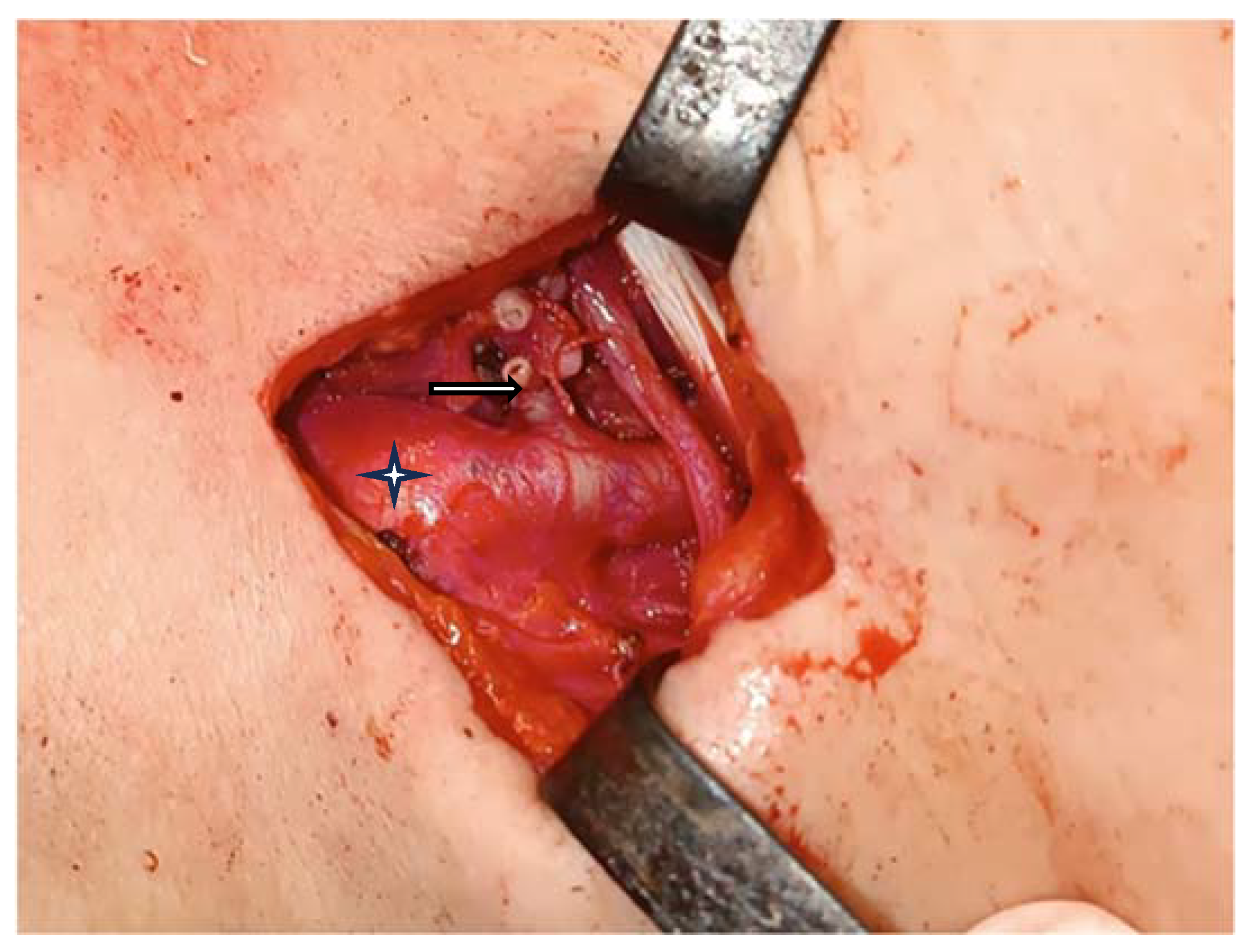 Medicina 60 00198 g004 Medicina 60 00198 g004