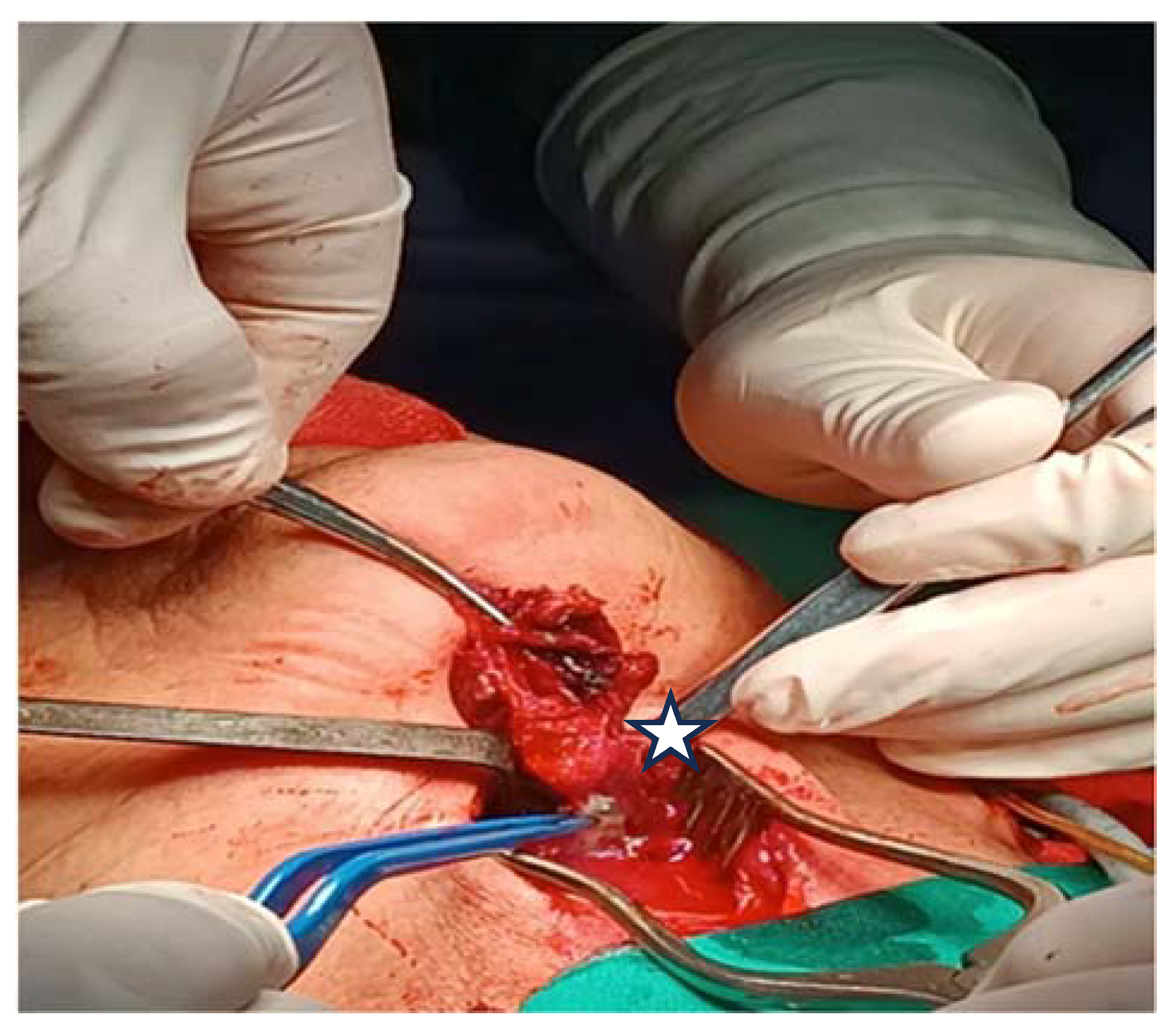 Medicina 60 00198 g005 Medicina 60 00198 g005