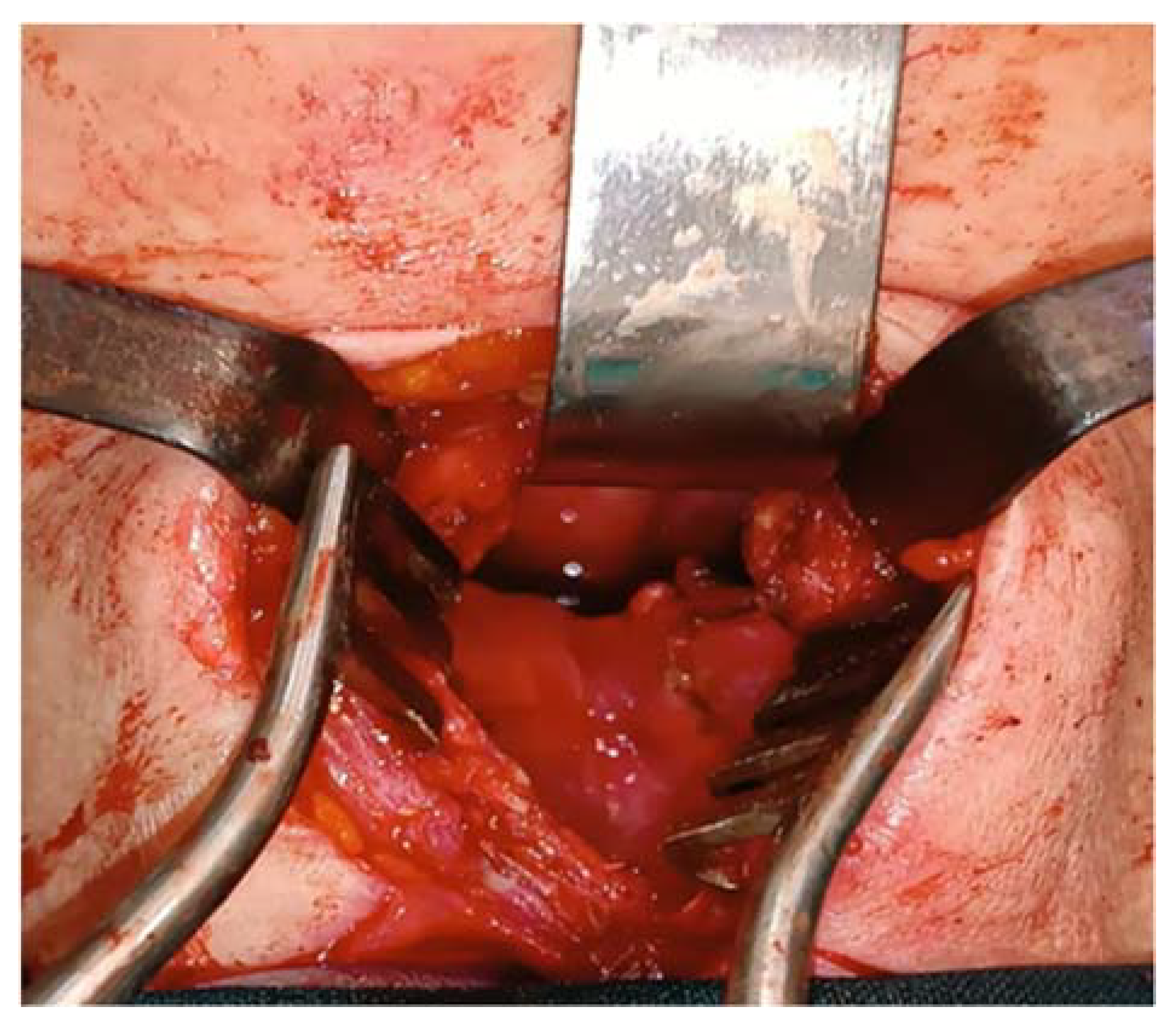 Medicina 60 00198 g006 Medicina 60 00198 g006