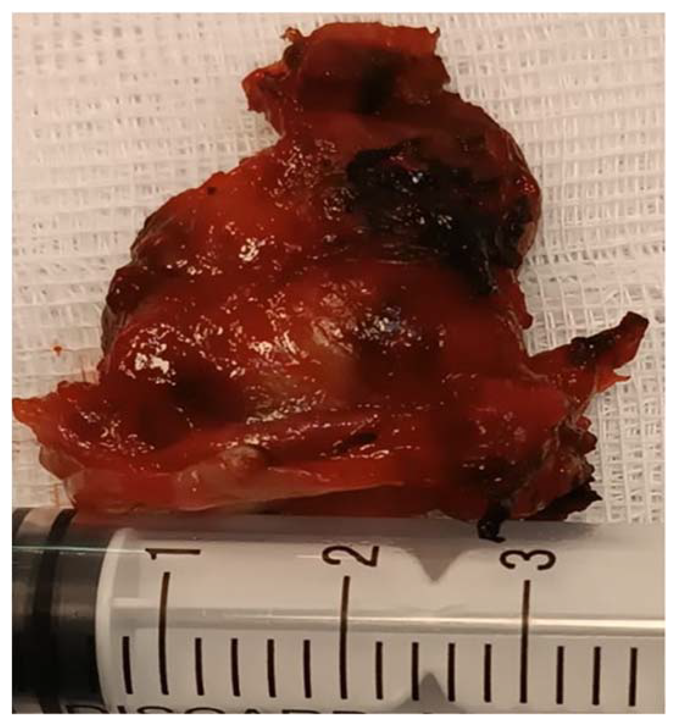 Medicina 60 00198 g007 Medicina 60 00198 g007