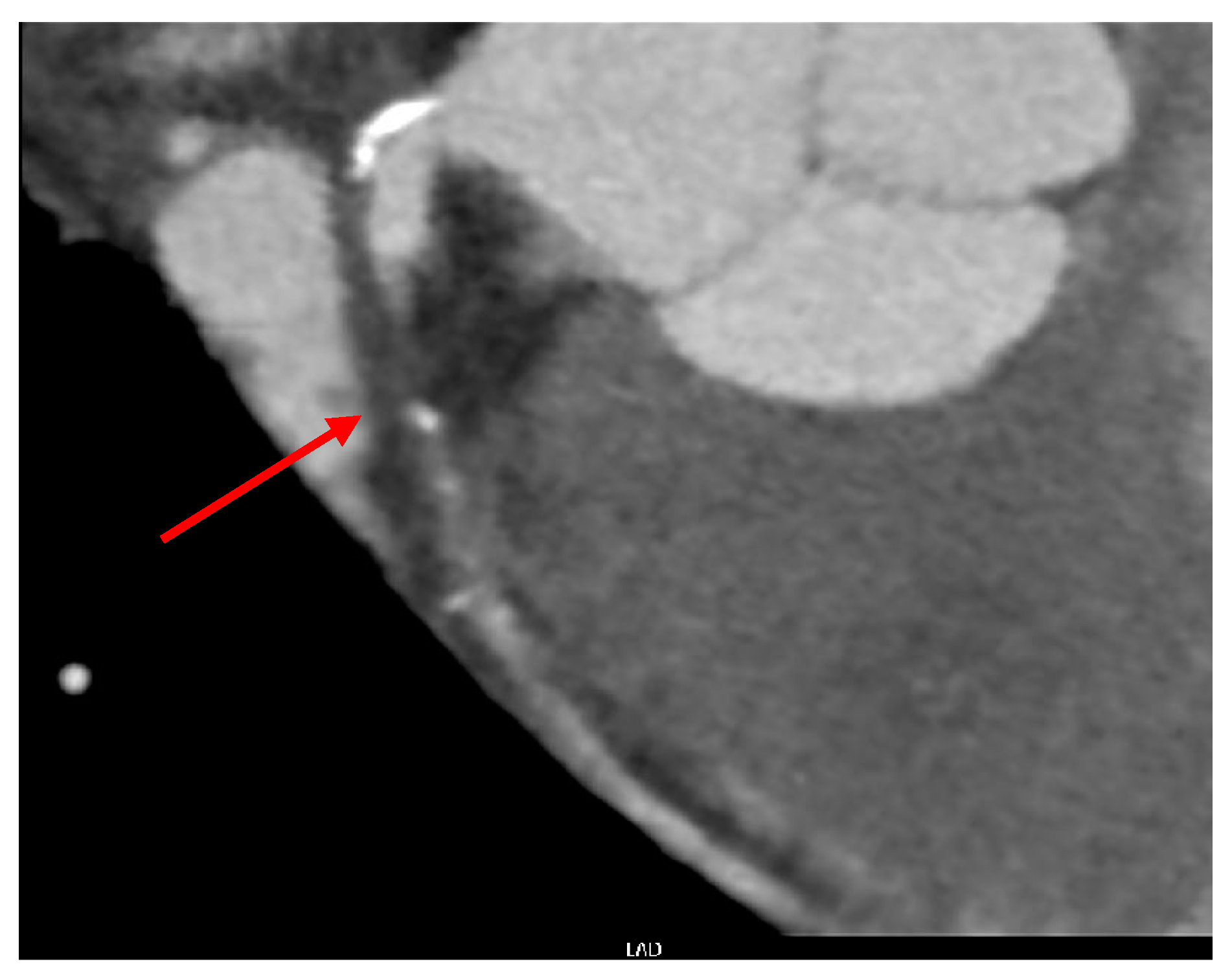 Medicina 60 00232 g003