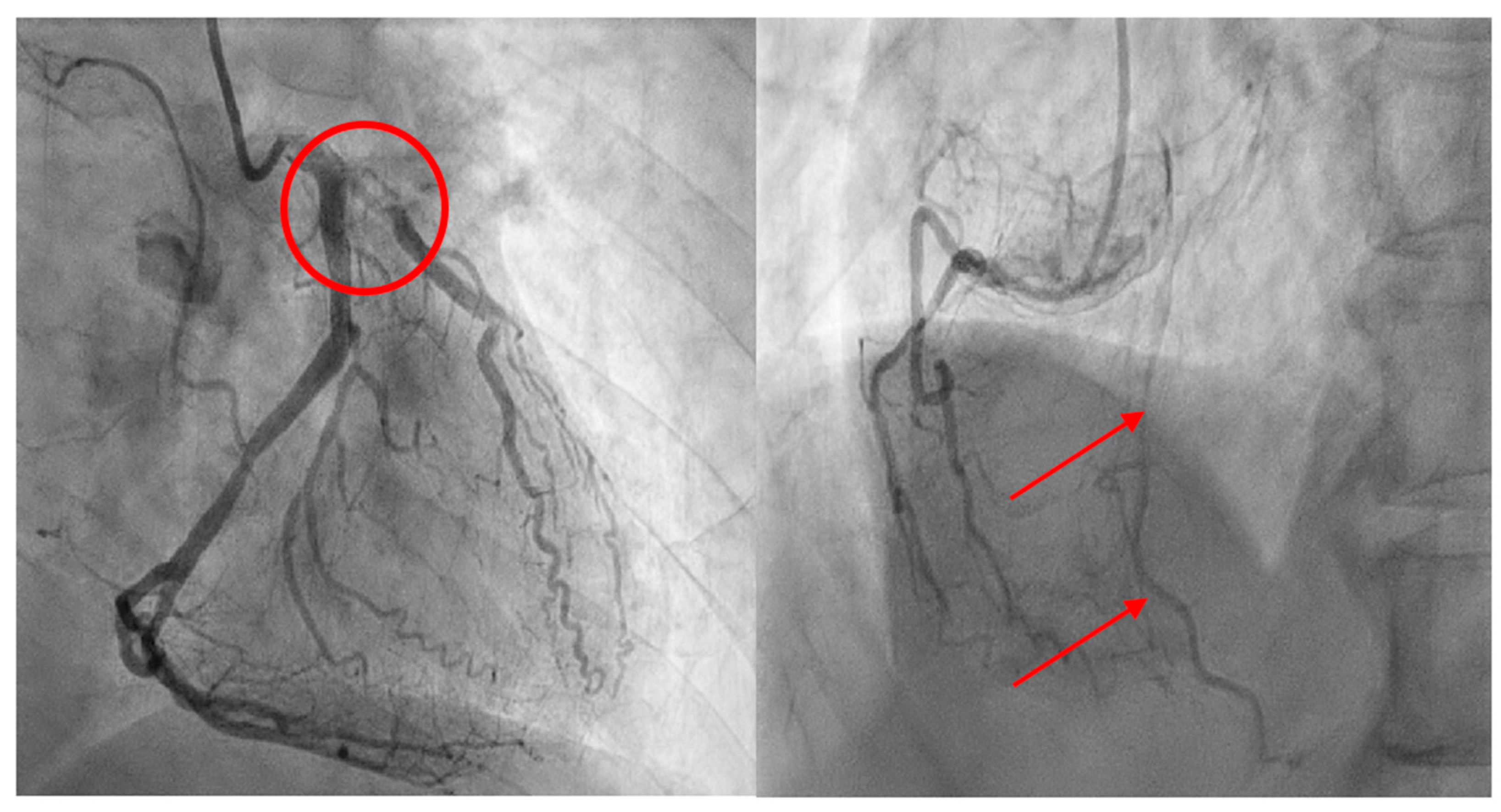 Medicina 60 00232 g004