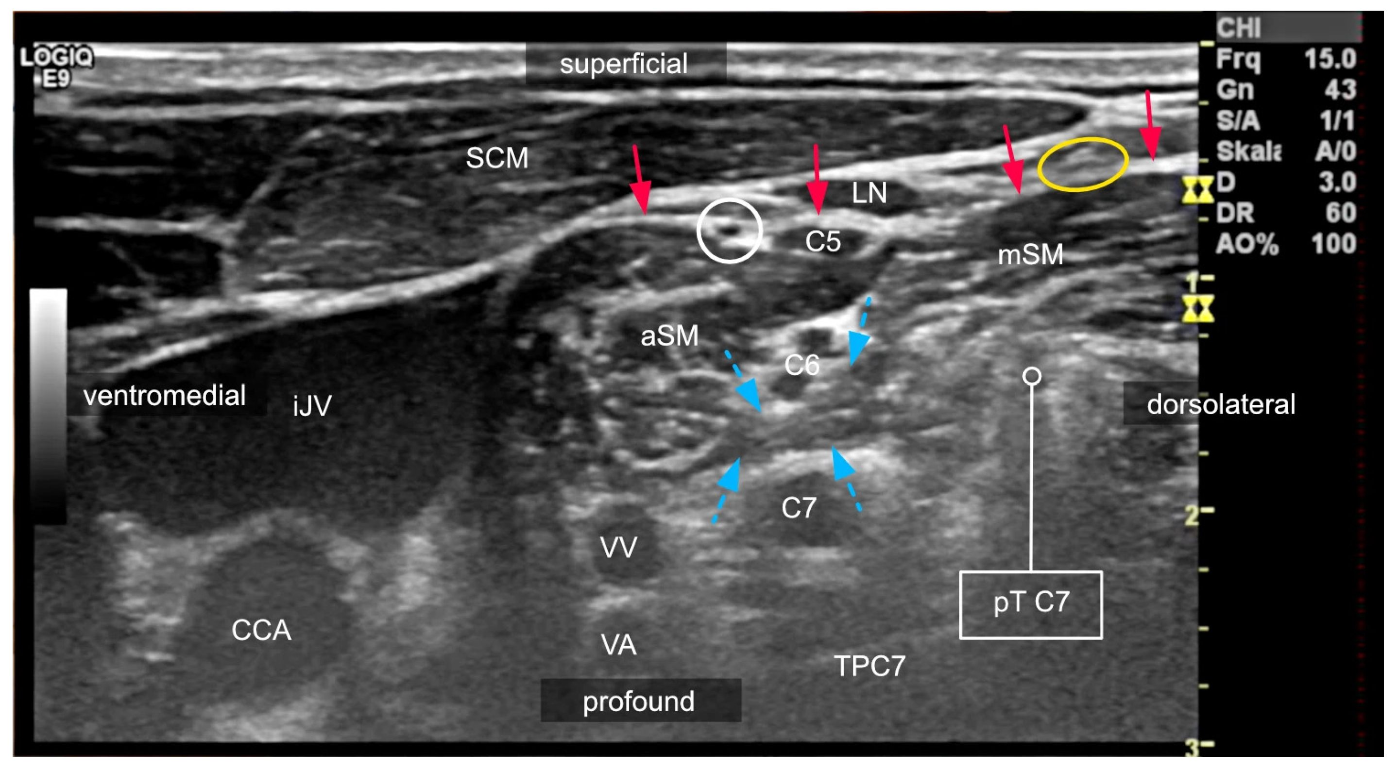 Medicina 60 00233 g003