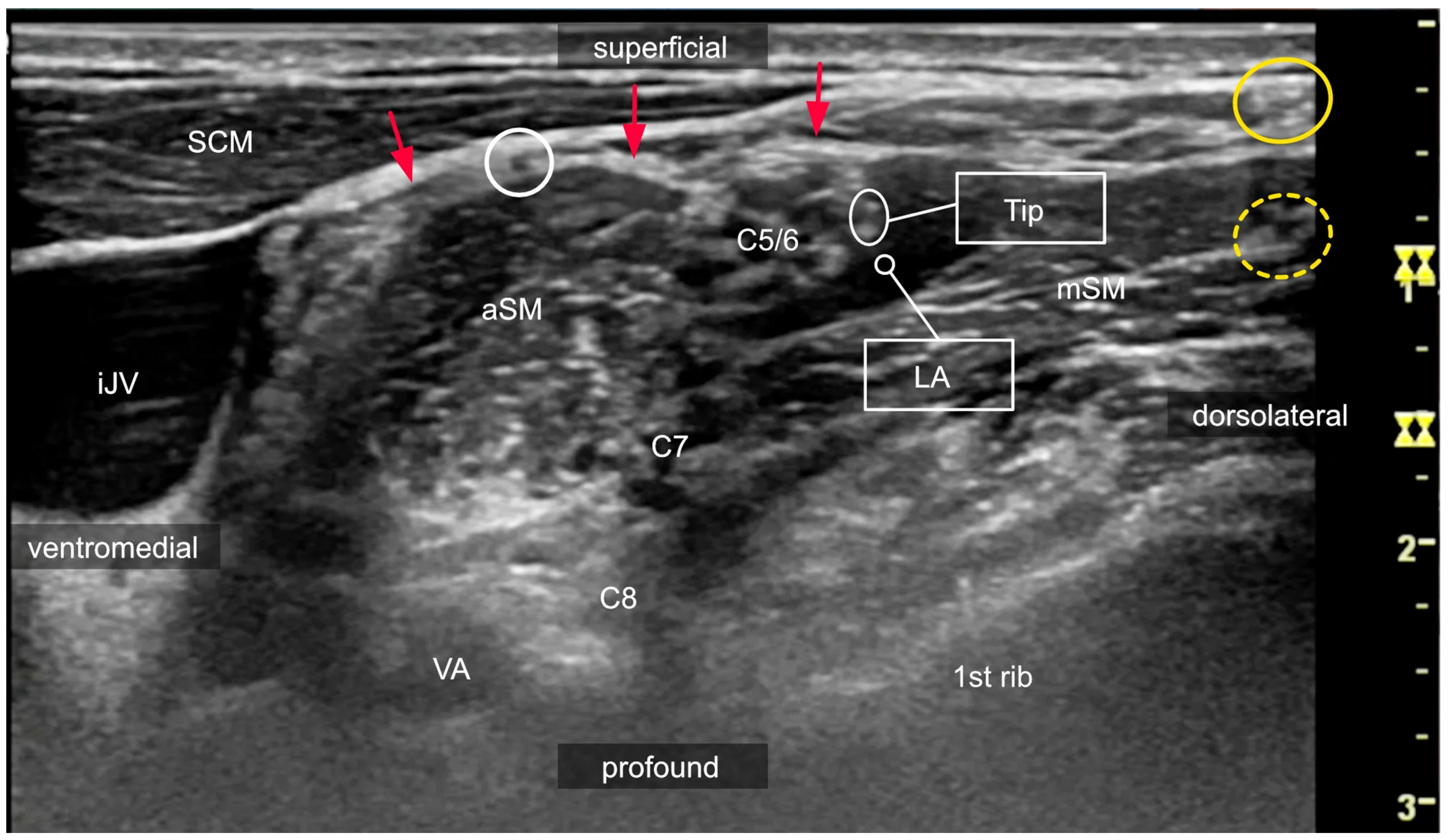 Medicina 60 00233 g008